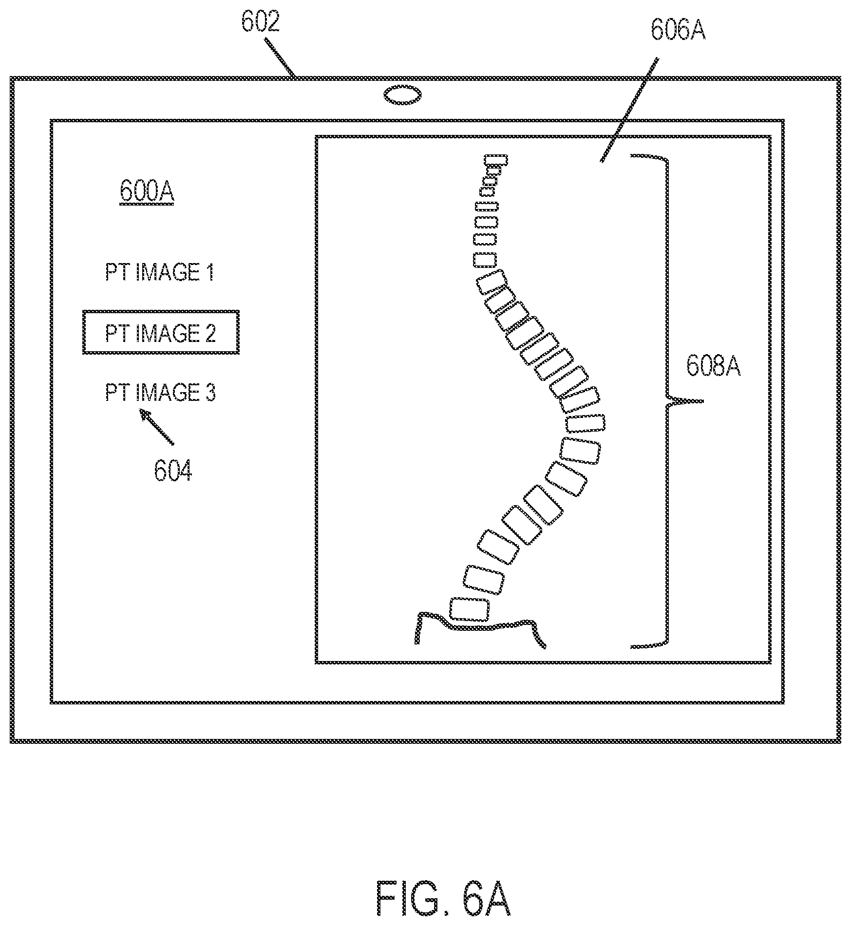 Patent US12318144 Figure 6 – Systems and methods for planning a patient-specific spinal correction