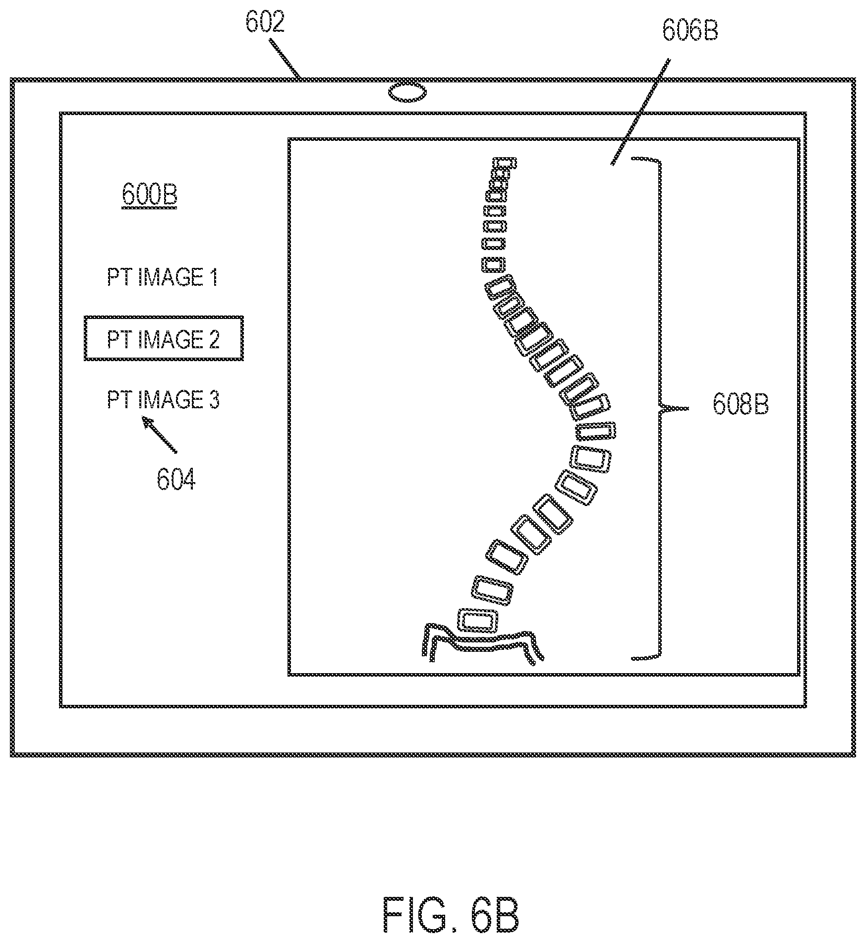 Patent US12318144 Figure 7 – Systems and methods for planning a patient-specific spinal correction