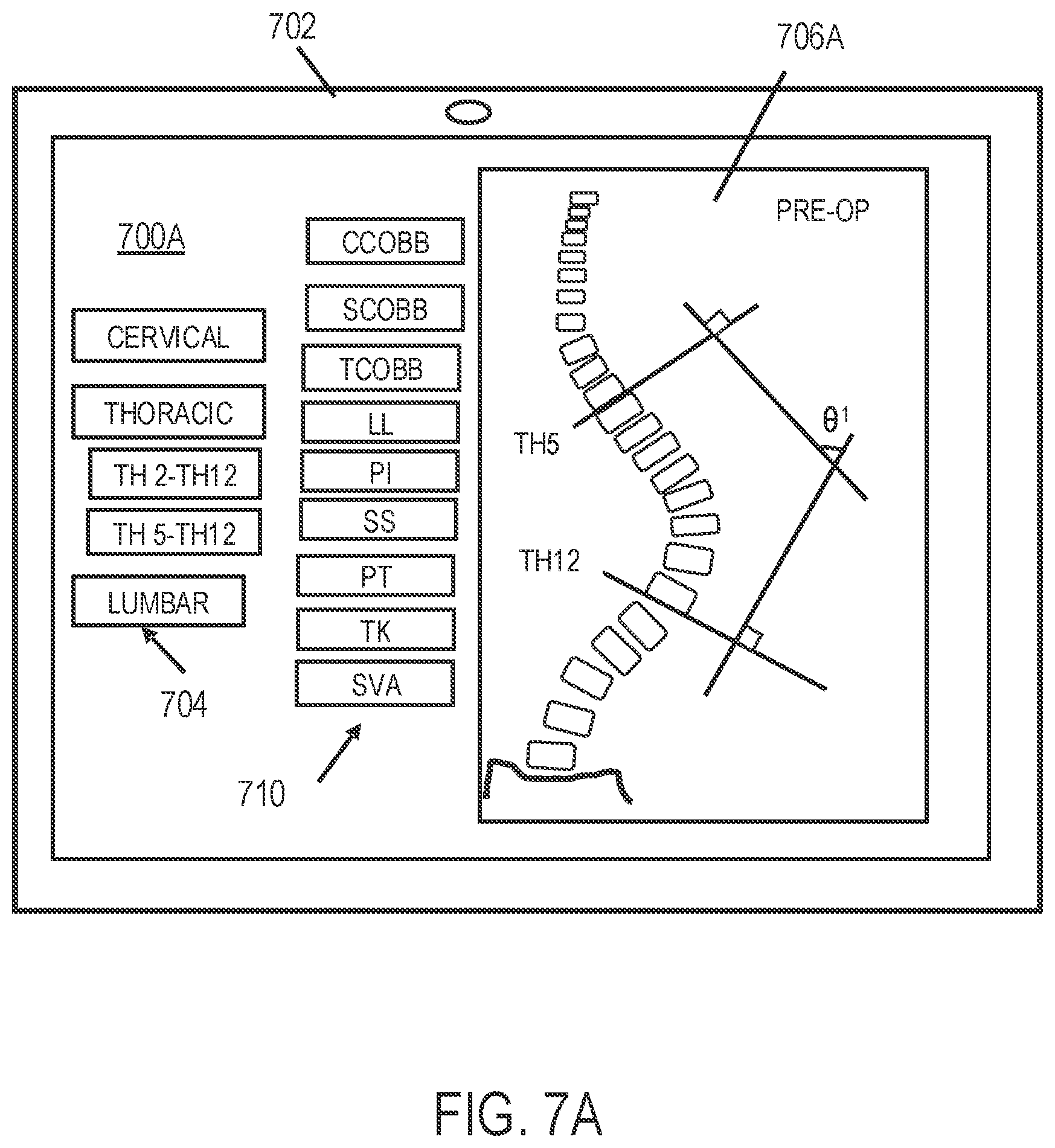 Patent US12318144 Figure 8 – Systems and methods for planning a patient-specific spinal correction