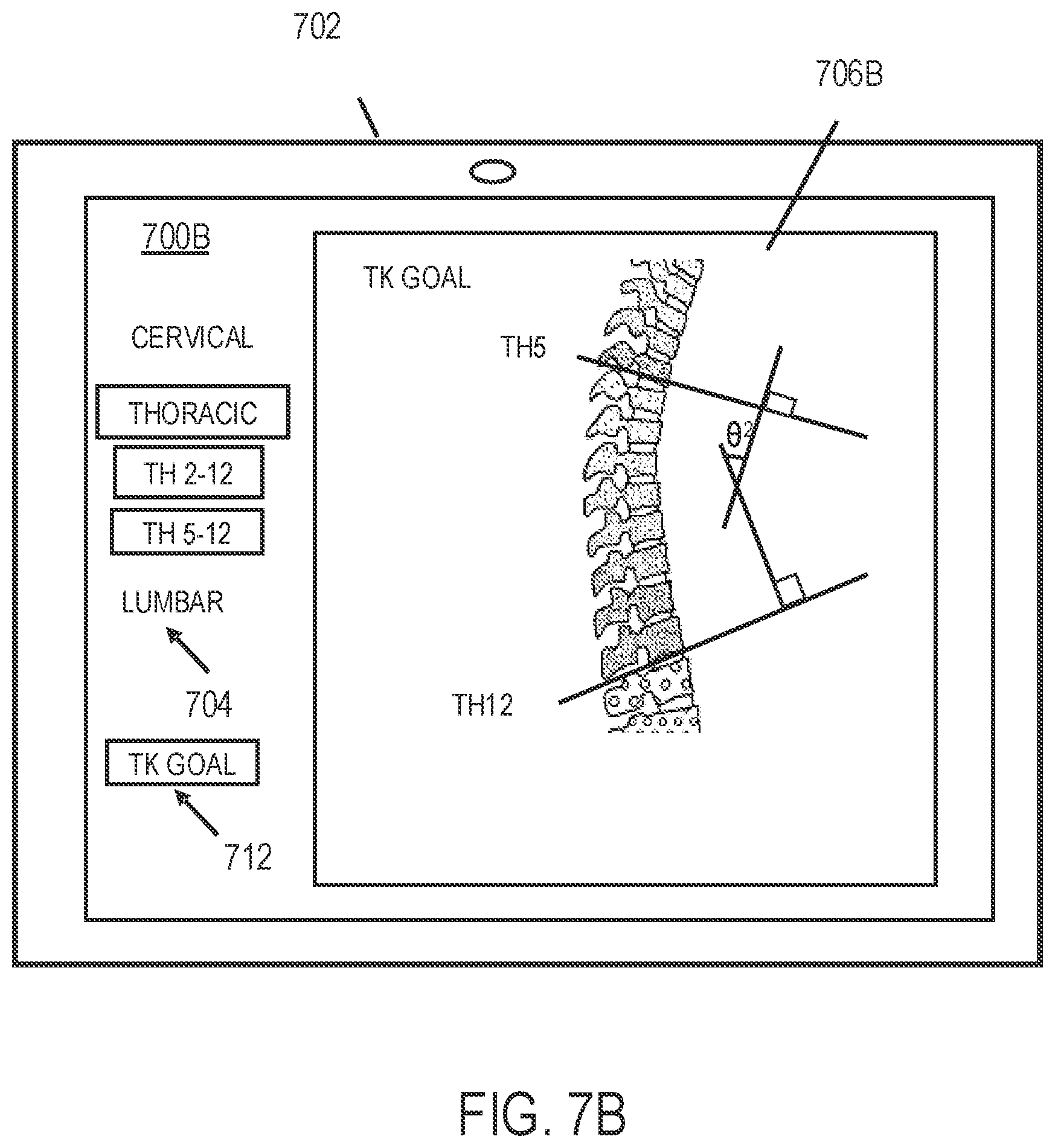 Patent US12318144 Figure 9 – Systems and methods for planning a patient-specific spinal correction