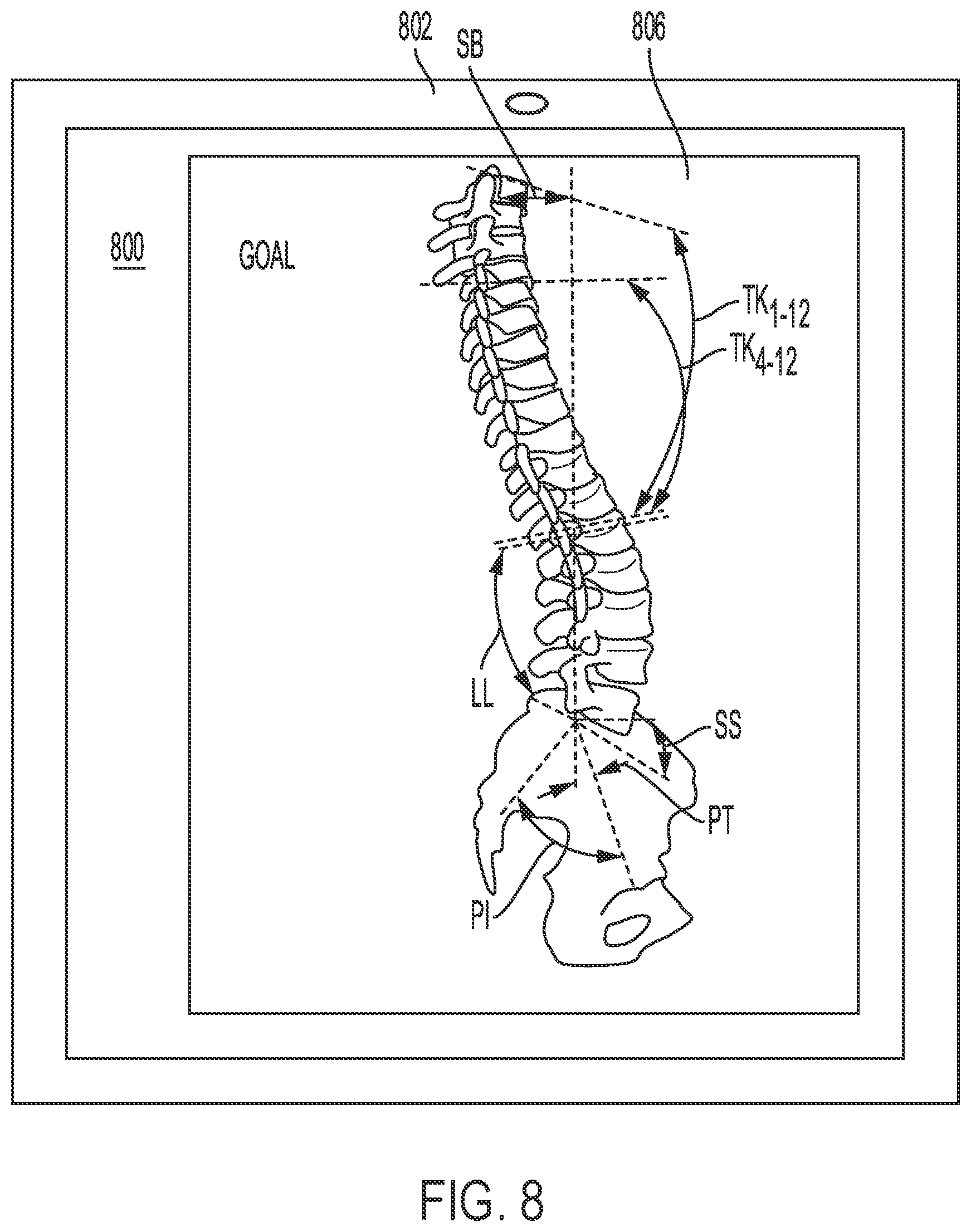 Patent US12318144 Figure 10 – Systems and methods for planning a patient-specific spinal correction
