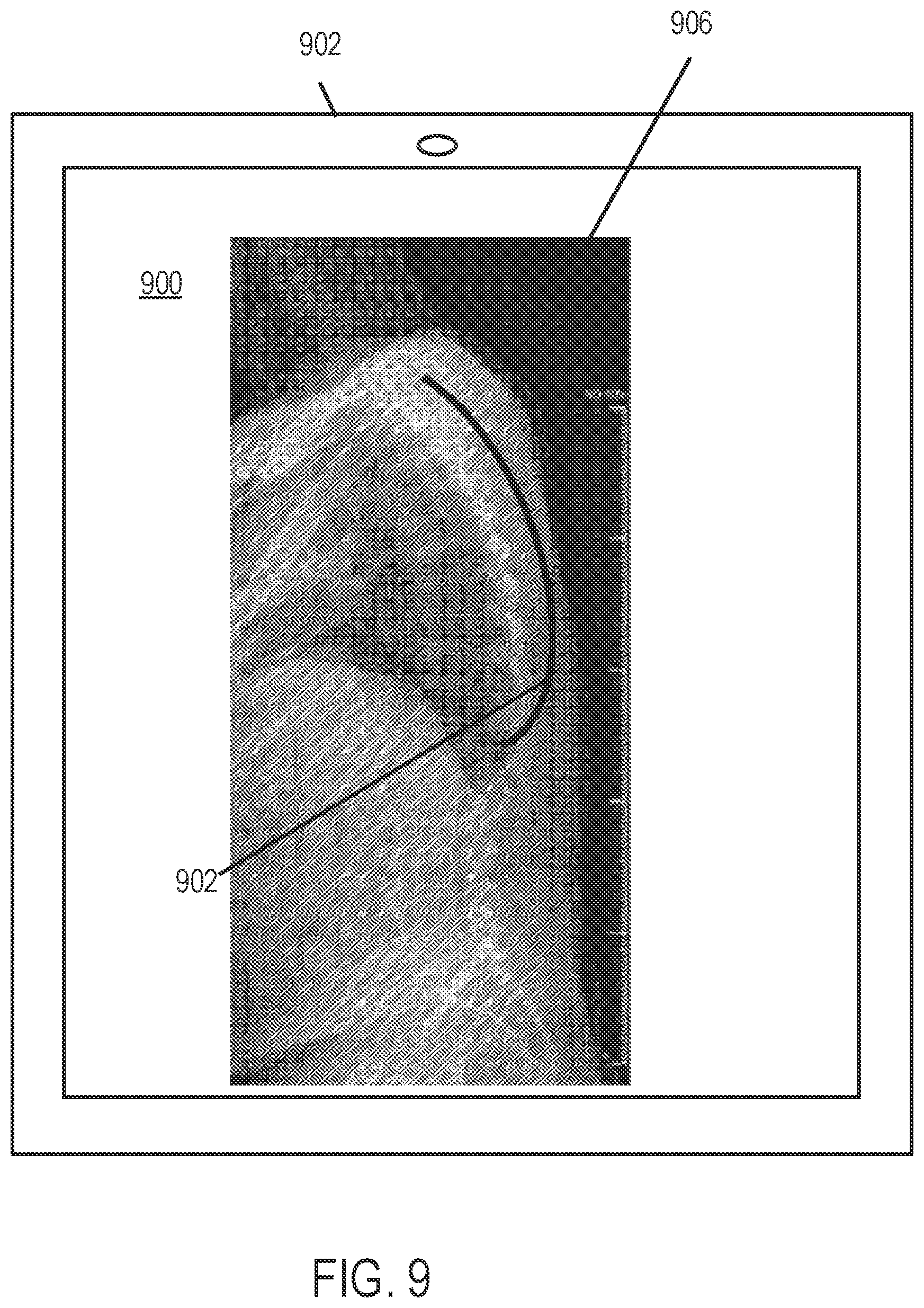 Patent US12318144 Figure 11 – Systems and methods for planning a patient-specific spinal correction