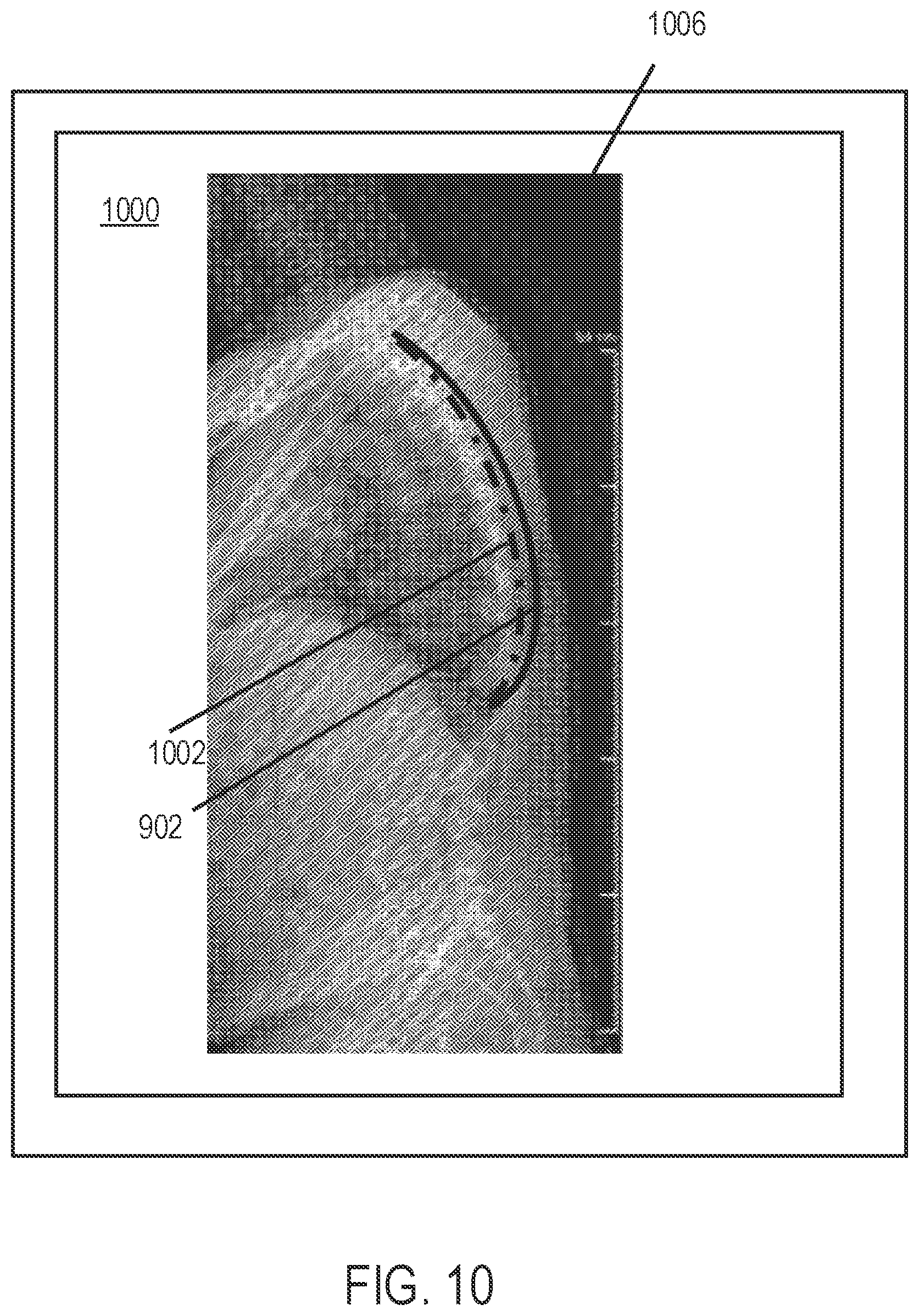 Patent US12318144 Figure 12 – Systems and methods for planning a patient-specific spinal correction