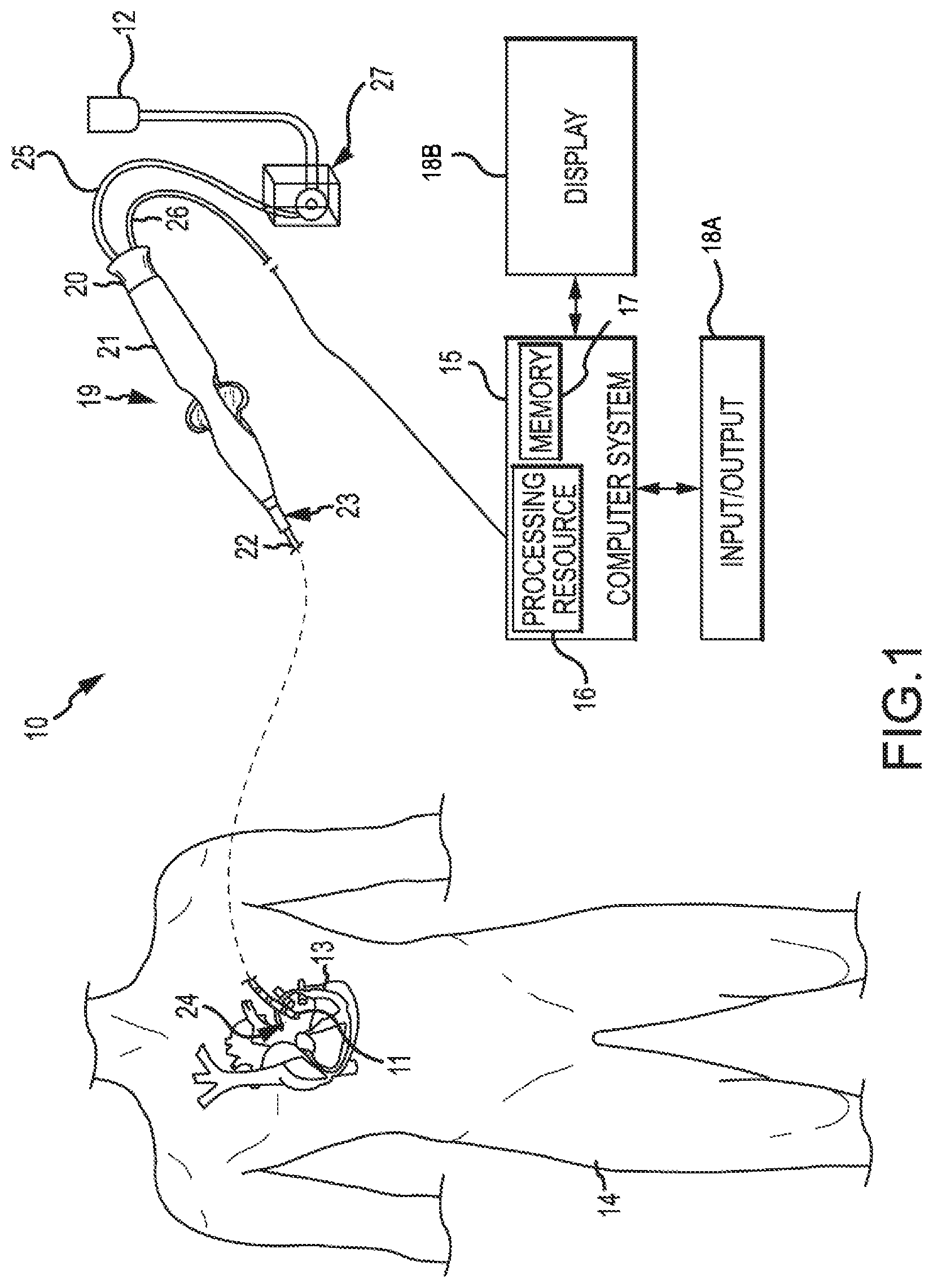 Patent US12318145 Figure 1 – Depicting force