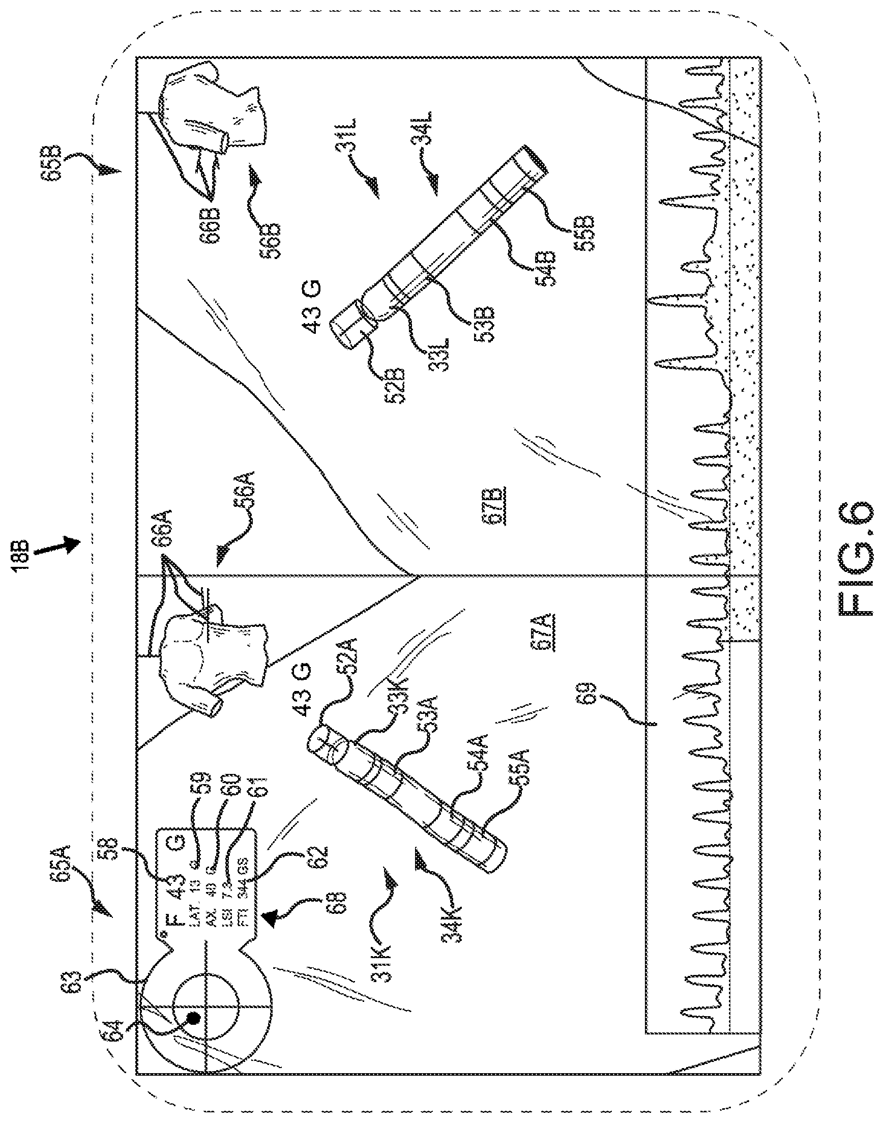 Patent US12318145 Figure 6 – Depicting force