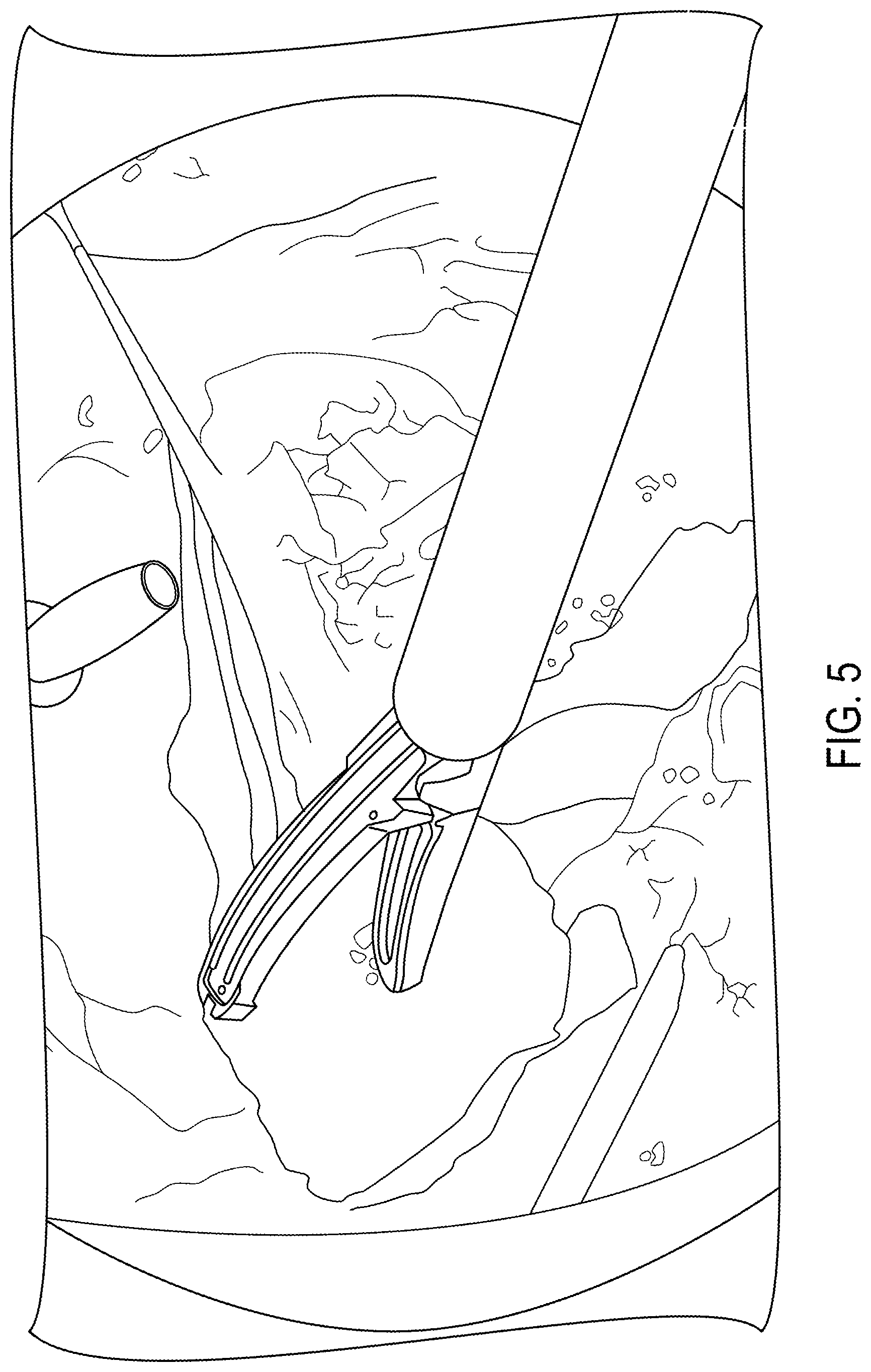 Patent US12318147 Figure 5 – Hot device indication of video display