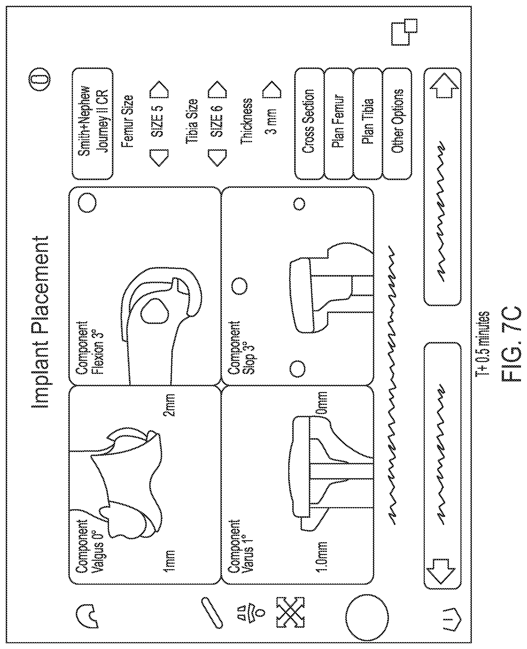 Patent US12318148 Figure 11 – Tracking device for hand tracking in surgical environment