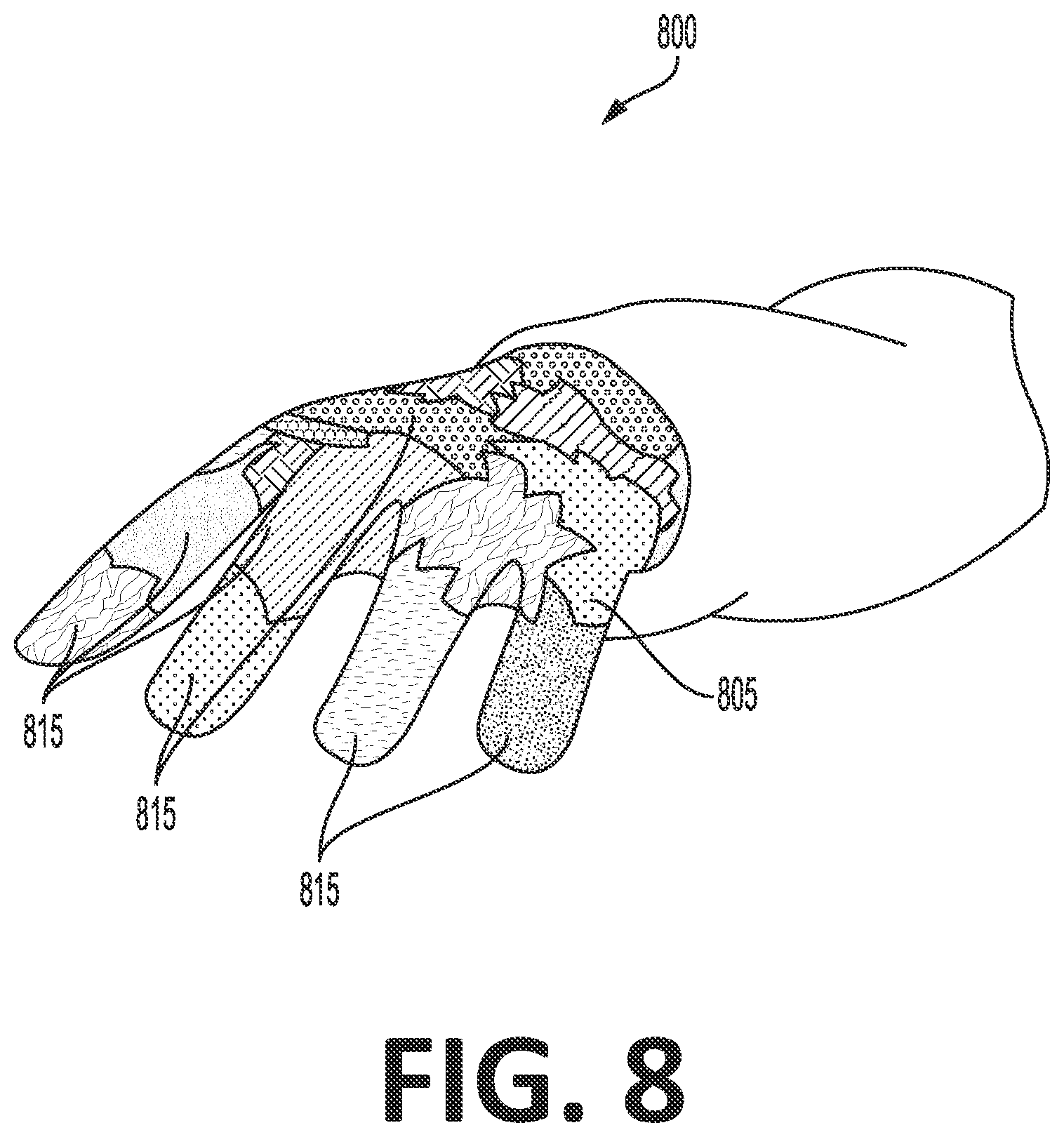 Patent US12318148 Figure 14 – Tracking device for hand tracking in surgical environment