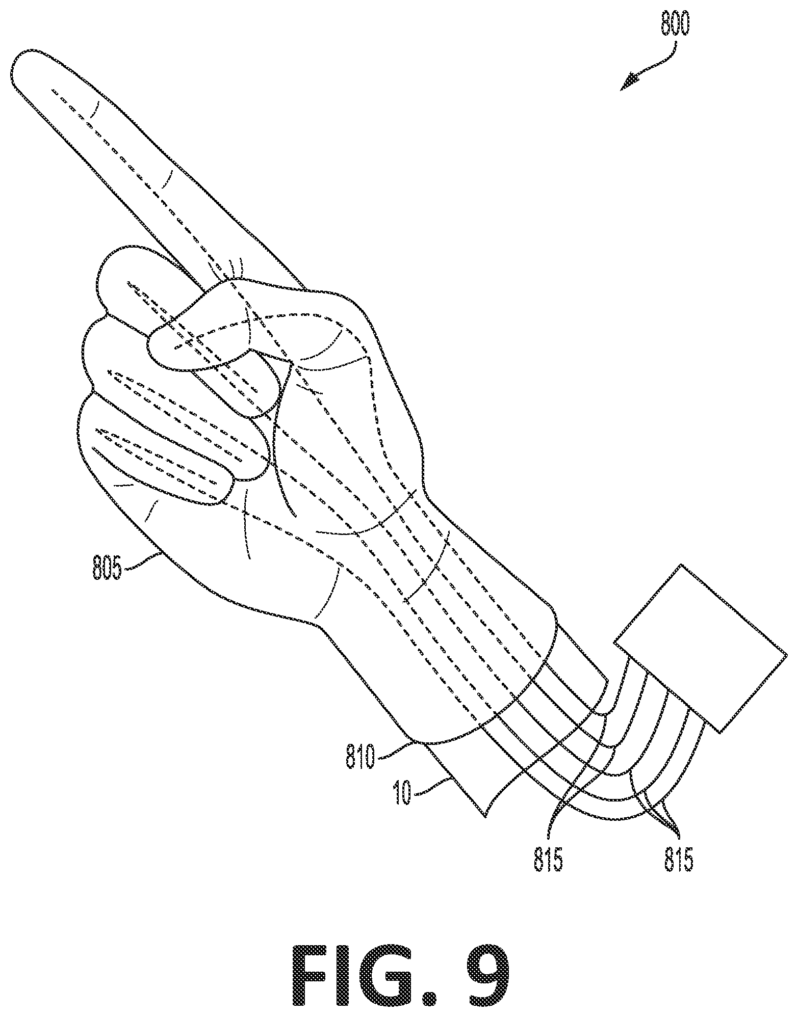 Patent US12318148 Figure 15 – Tracking device for hand tracking in surgical environment