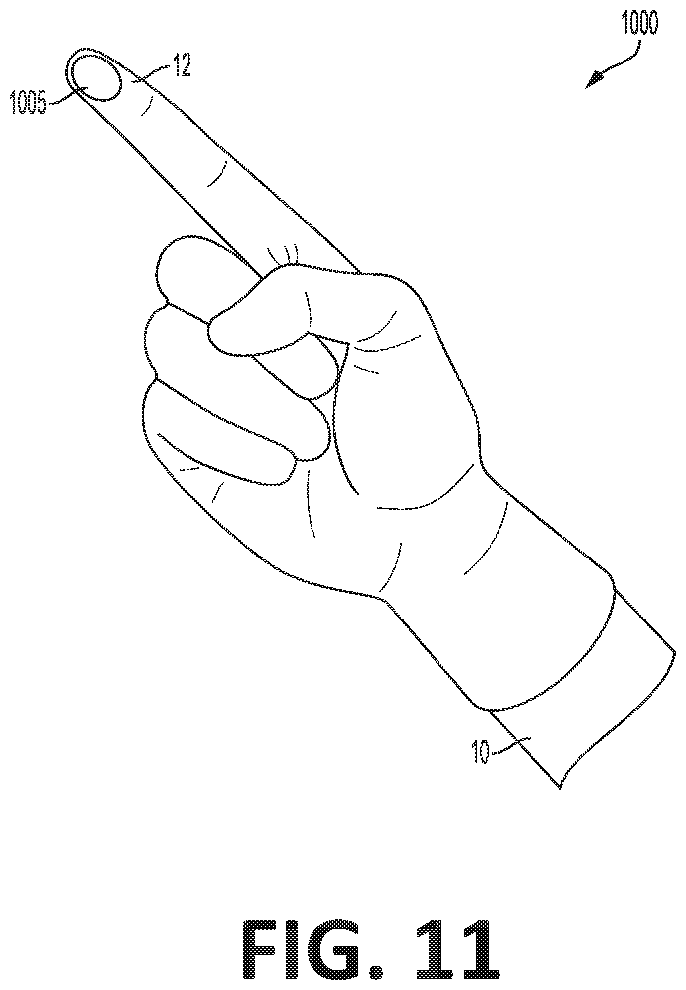 Patent US12318148 Figure 17 – Tracking device for hand tracking in surgical environment