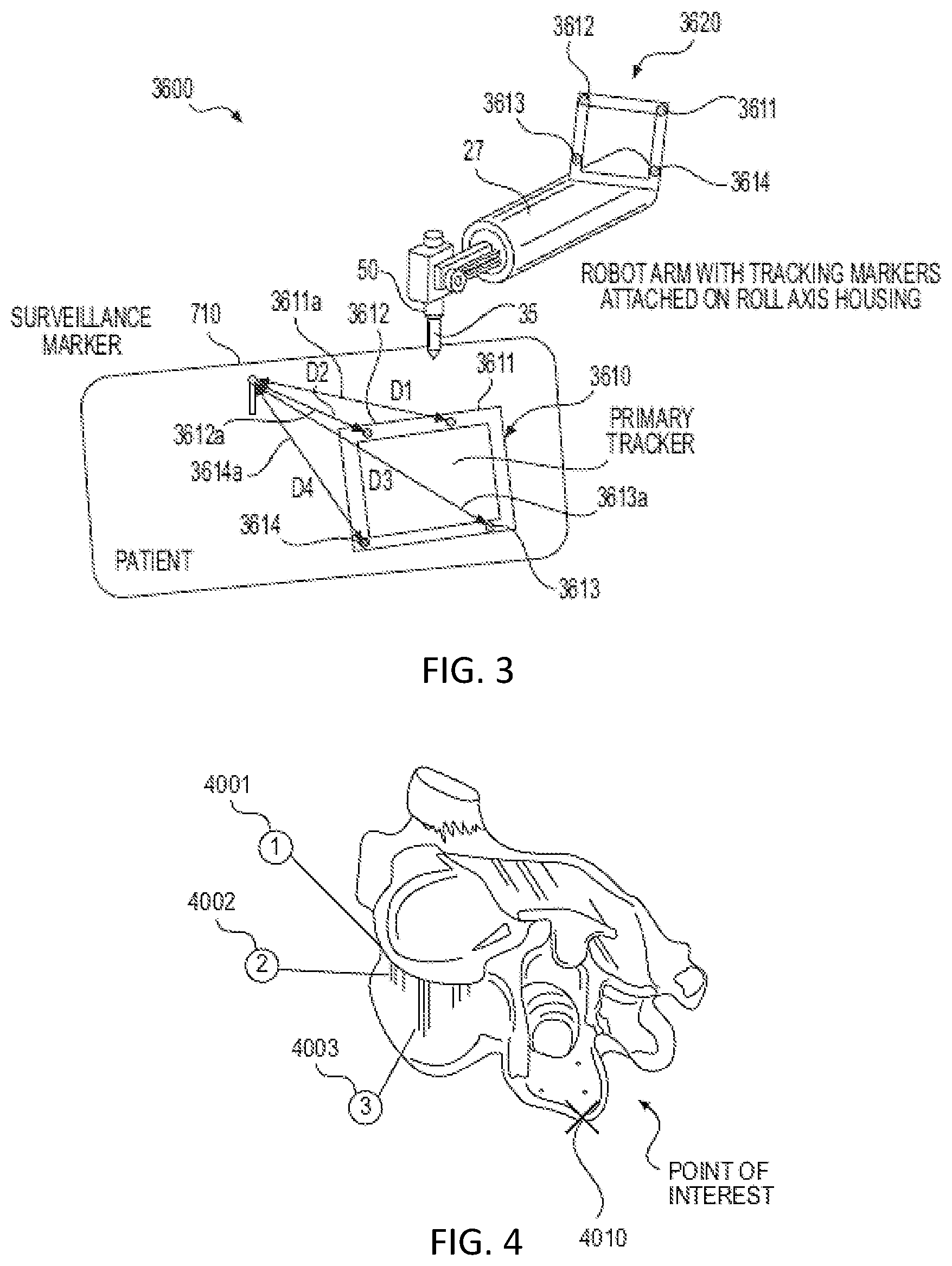 Patent US12318153 Figure 3 – Surgical robot platform