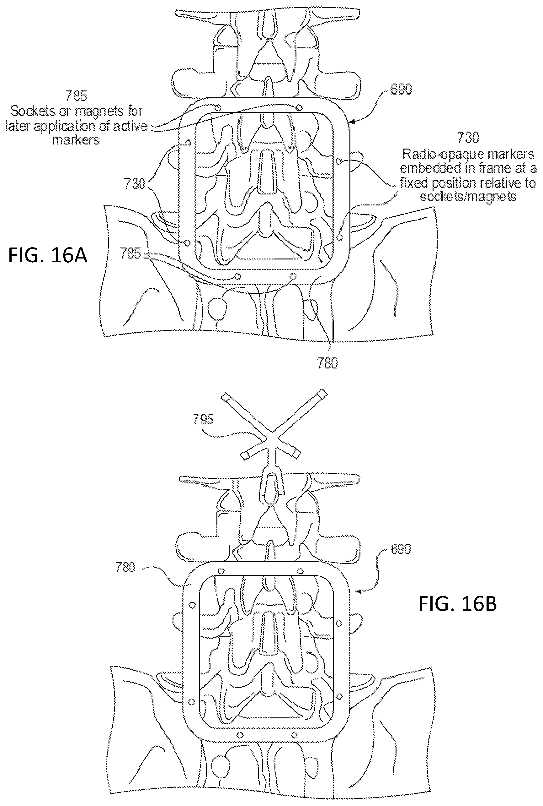 Patent US12318153 Figure 10 – Surgical robot platform