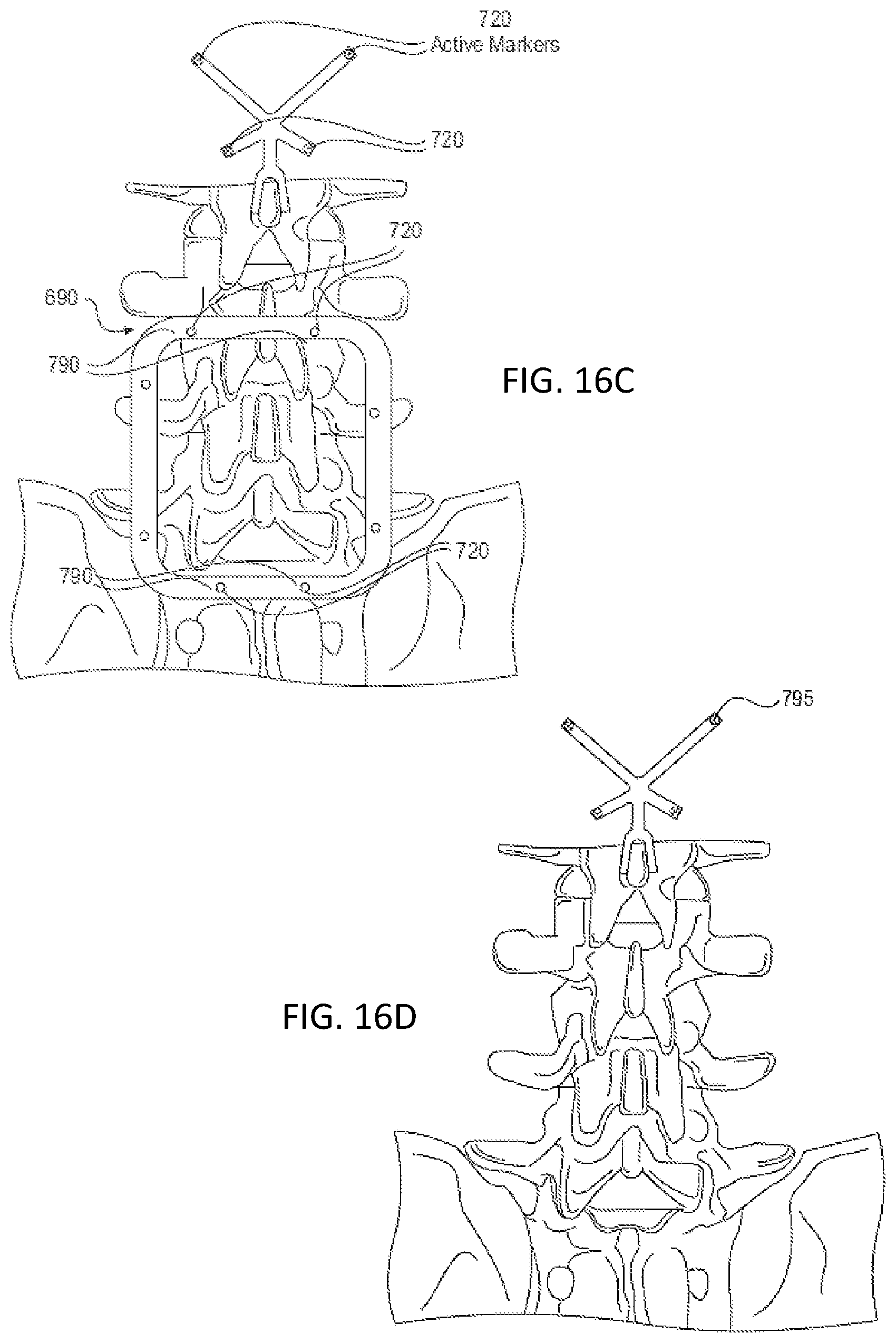 Patent US12318153 Figure 11 – Surgical robot platform
