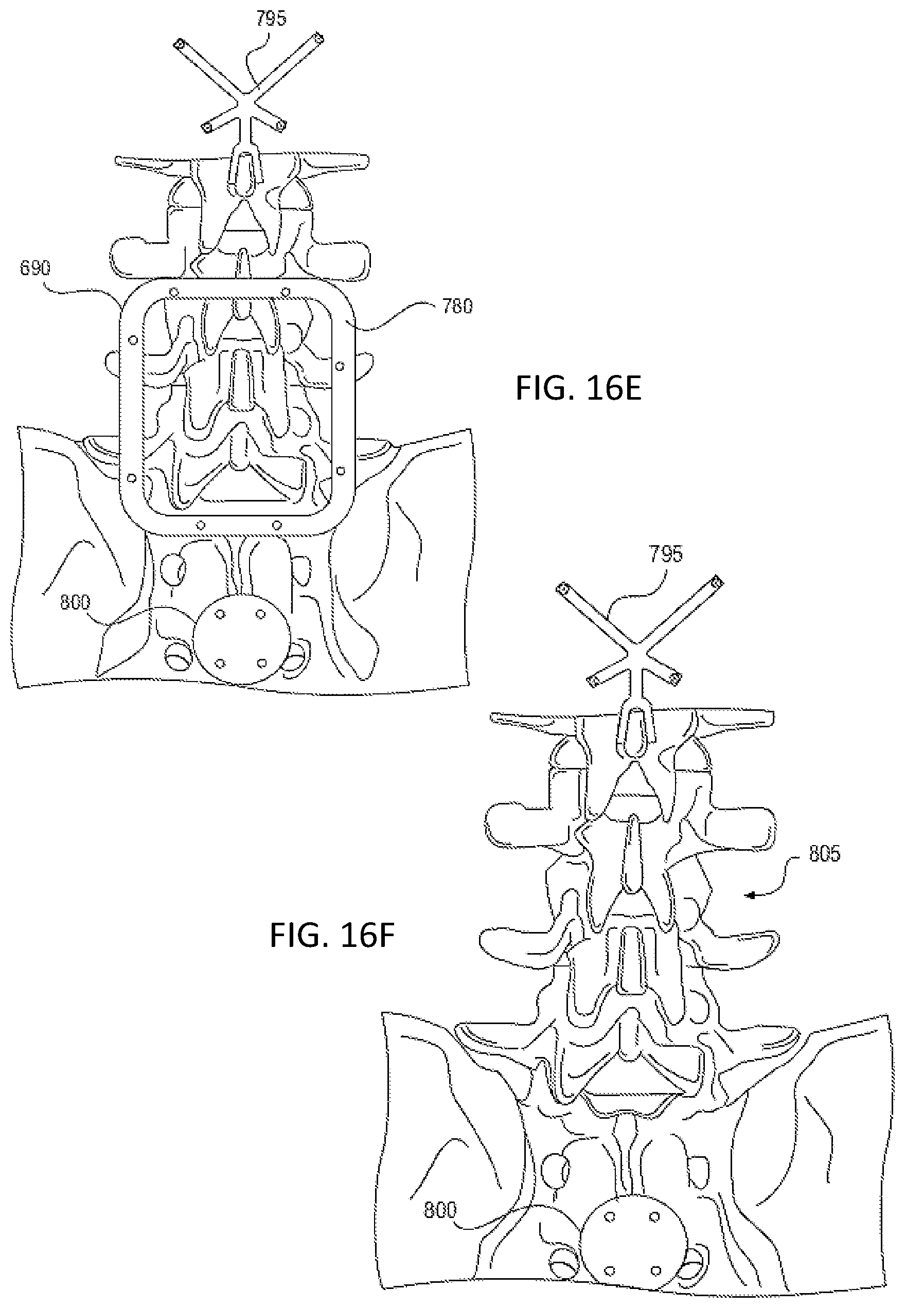 Patent US12318153 Figure 12 – Surgical robot platform