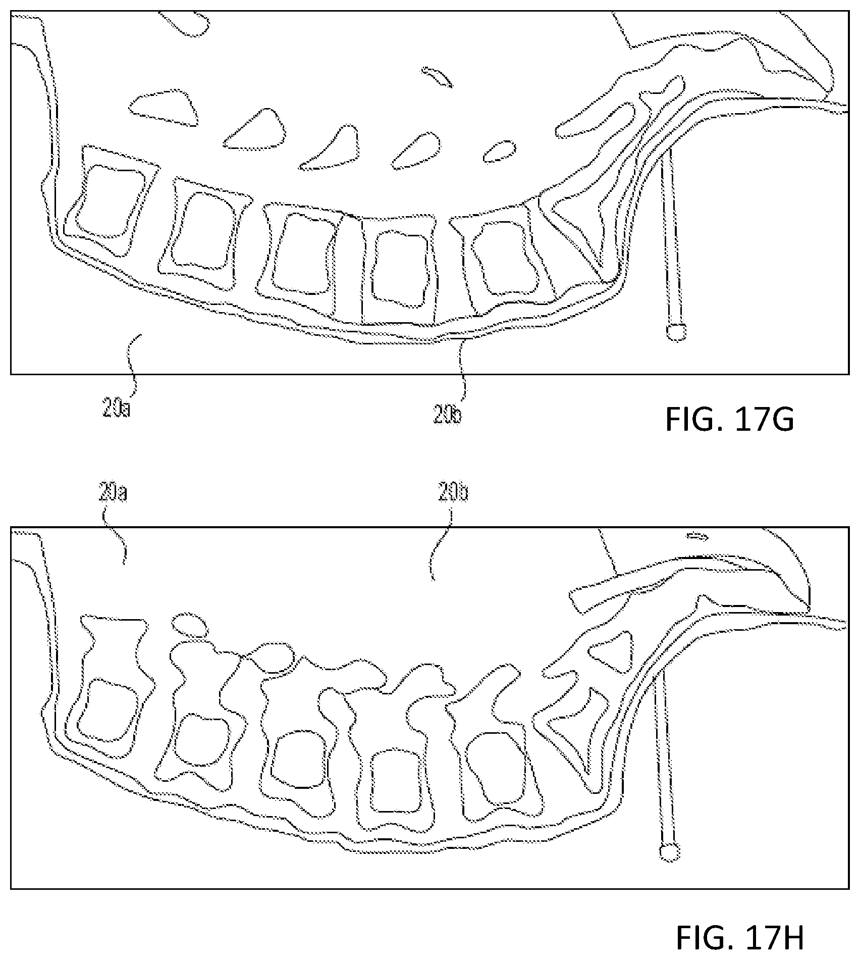 Patent US12318153 Figure 16 – Surgical robot platform