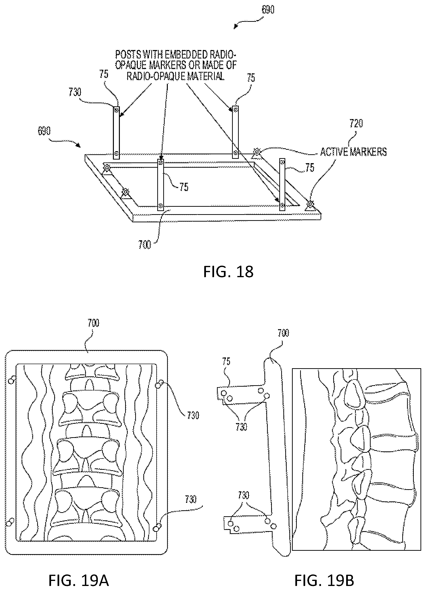 Patent US12318153 Figure 17 – Surgical robot platform