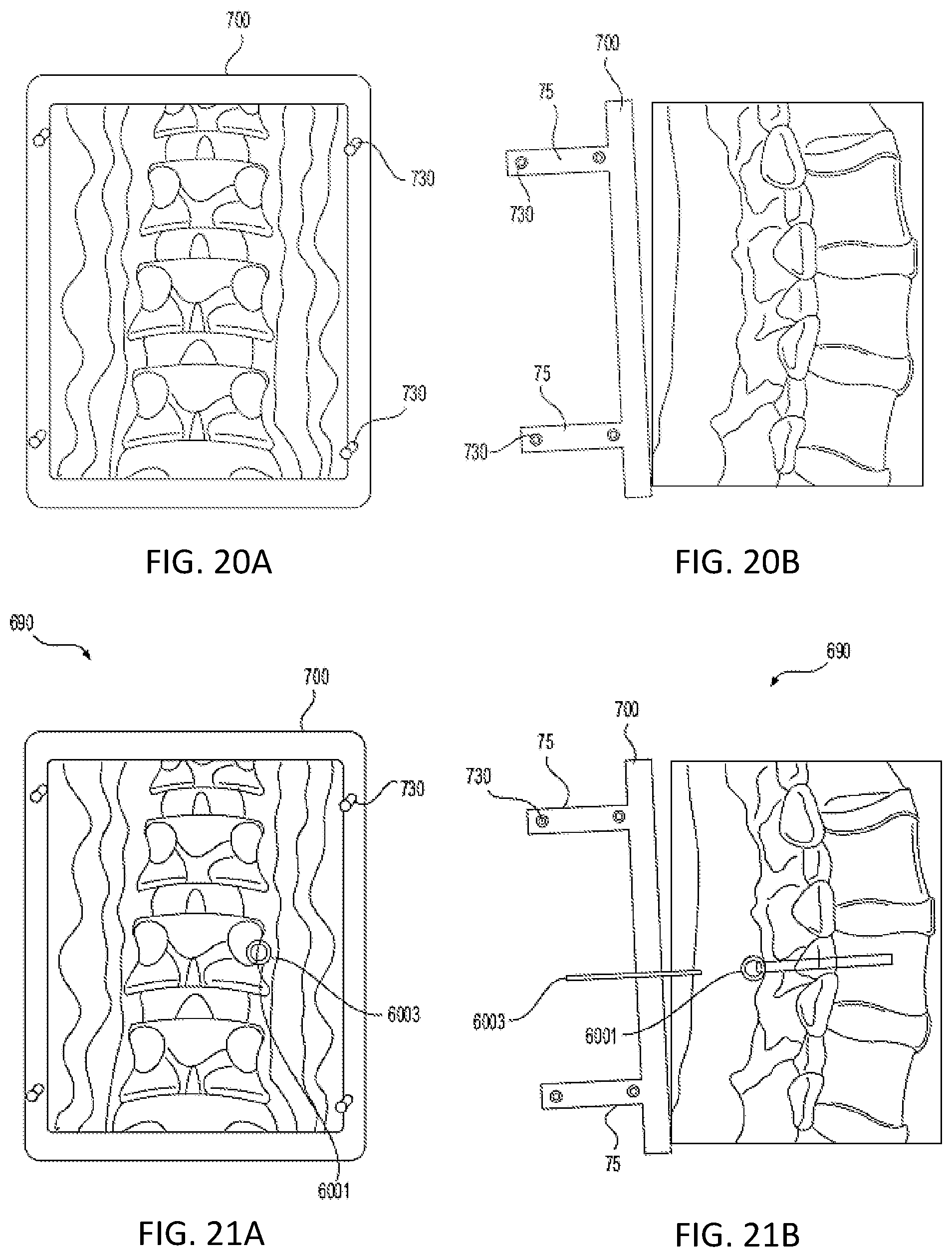 Patent US12318153 Figure 18 – Surgical robot platform