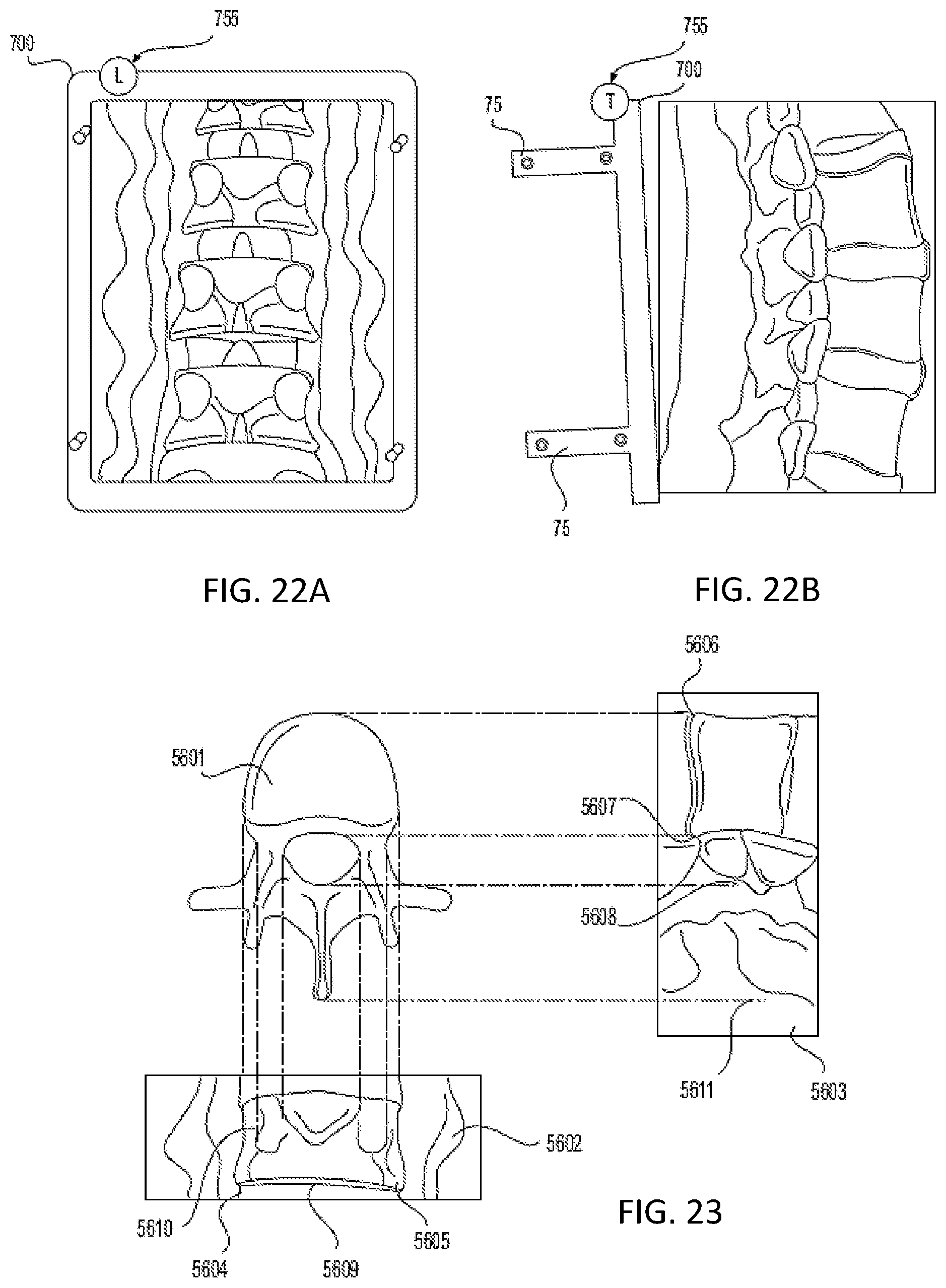 Patent US12318153 Figure 19 – Surgical robot platform