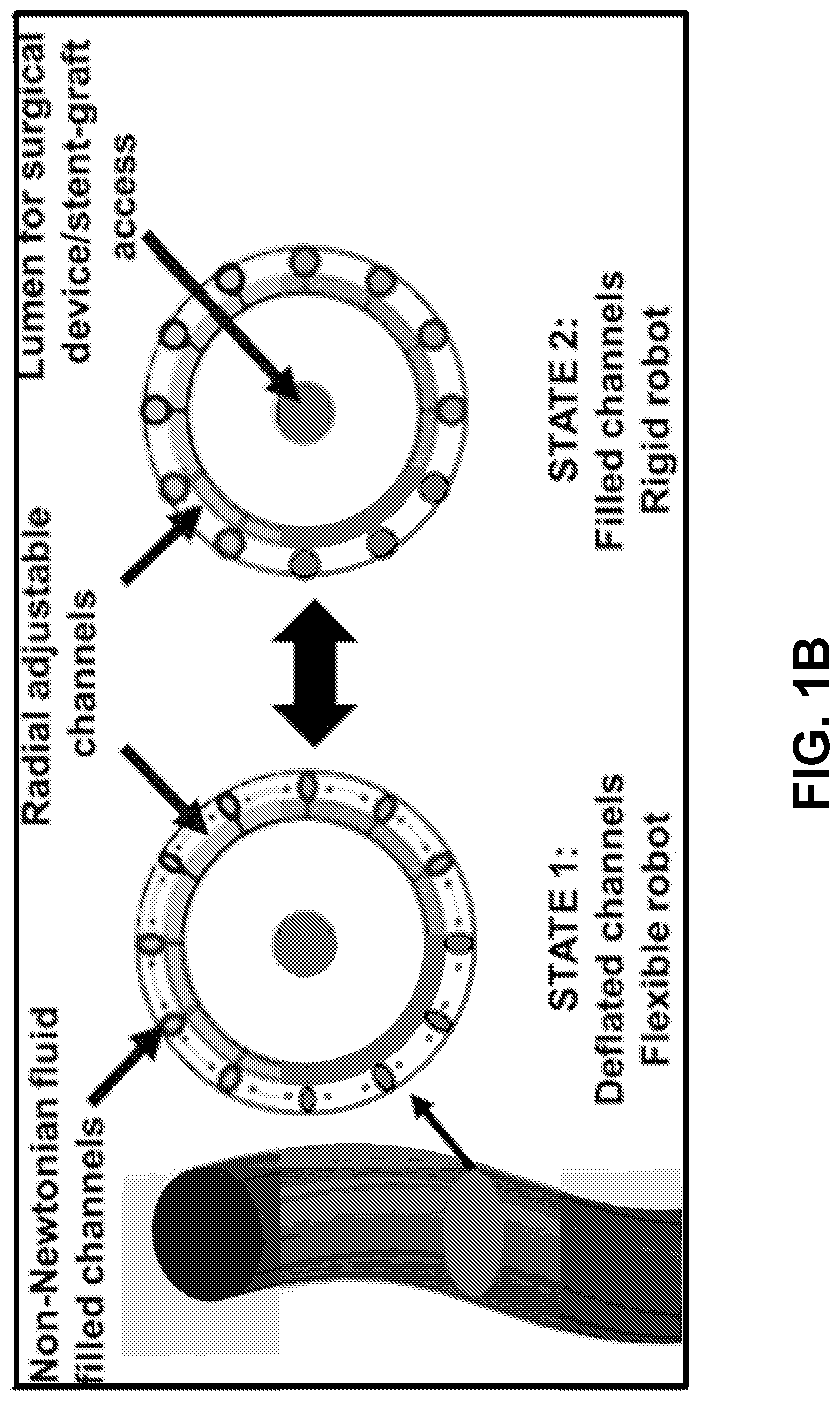 Patent US12318158 Figure 2 – Microrobotic systems and methods for endovascular interventions