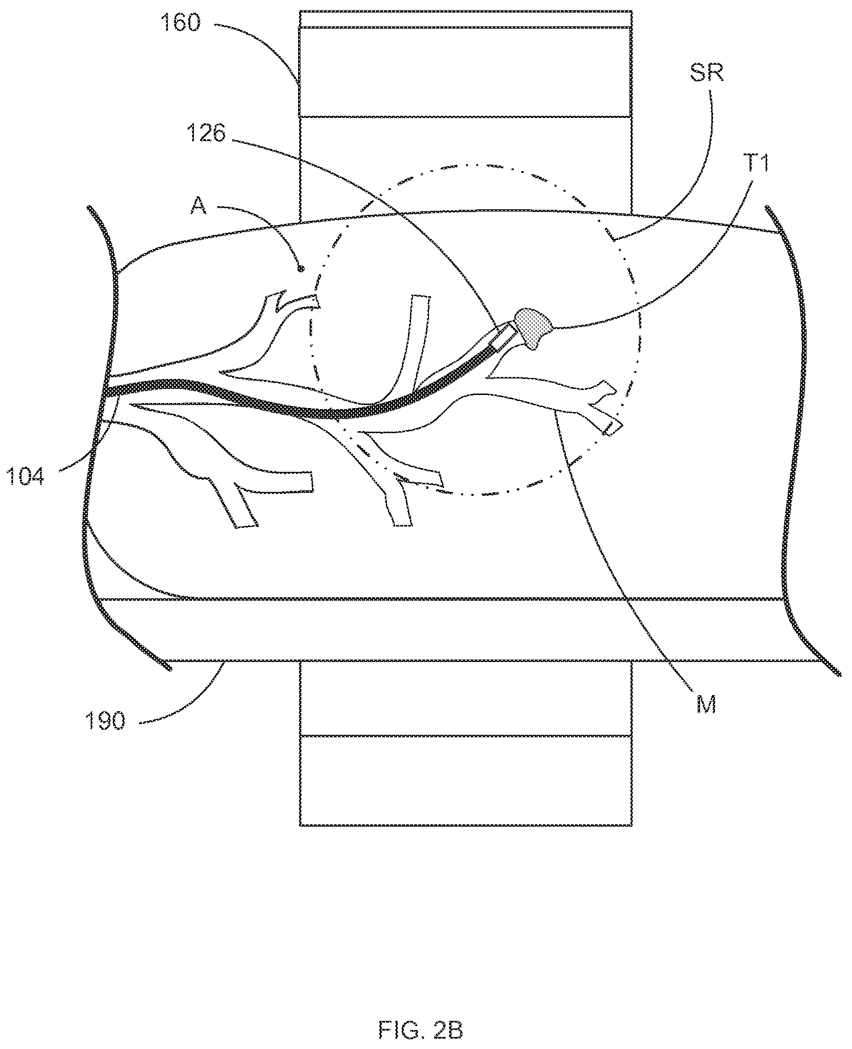 Patent US12318159 Figure 4 – Systems and methods for robotic medical system integration with external imaging