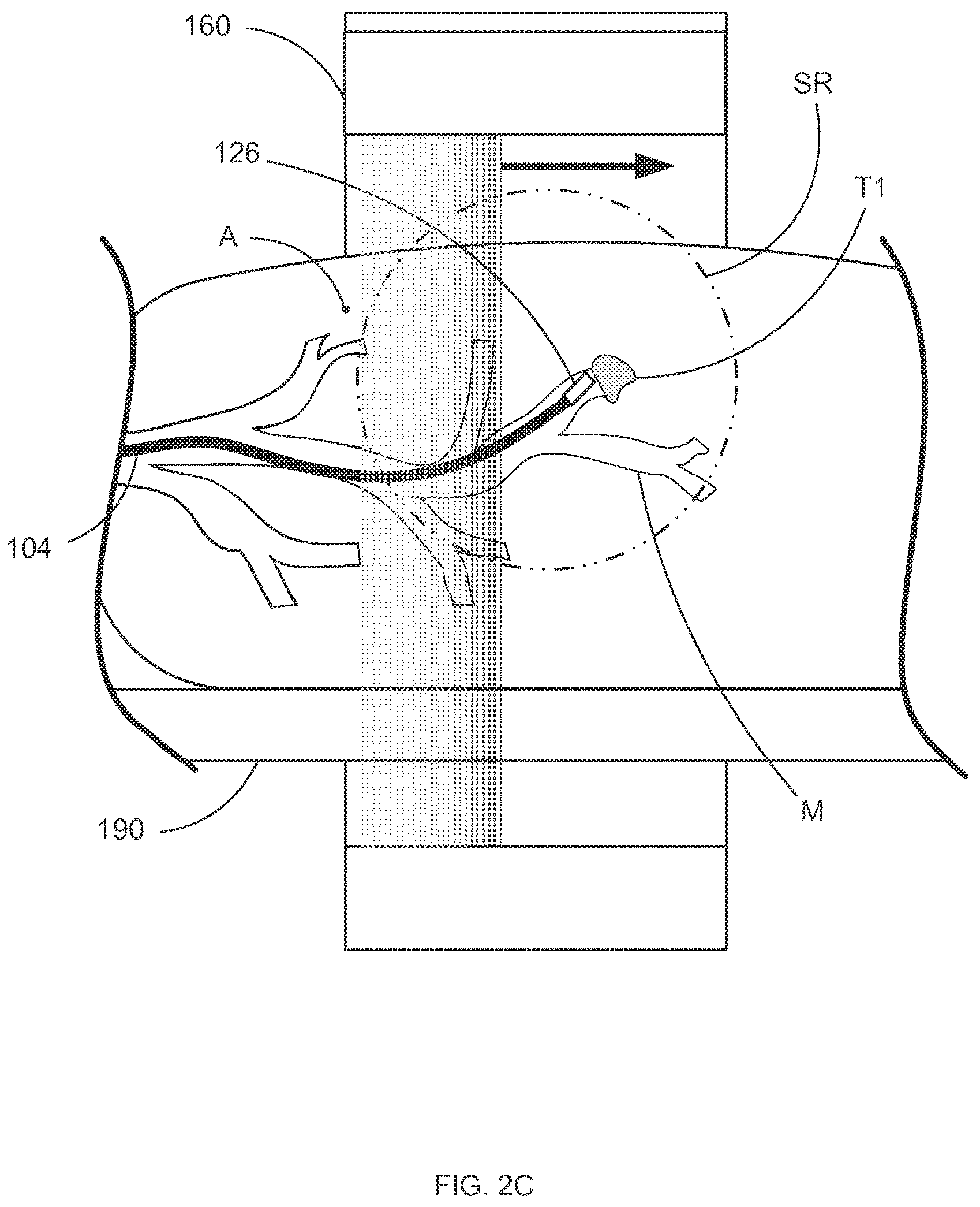 Patent US12318159 Figure 5 – Systems and methods for robotic medical system integration with external imaging