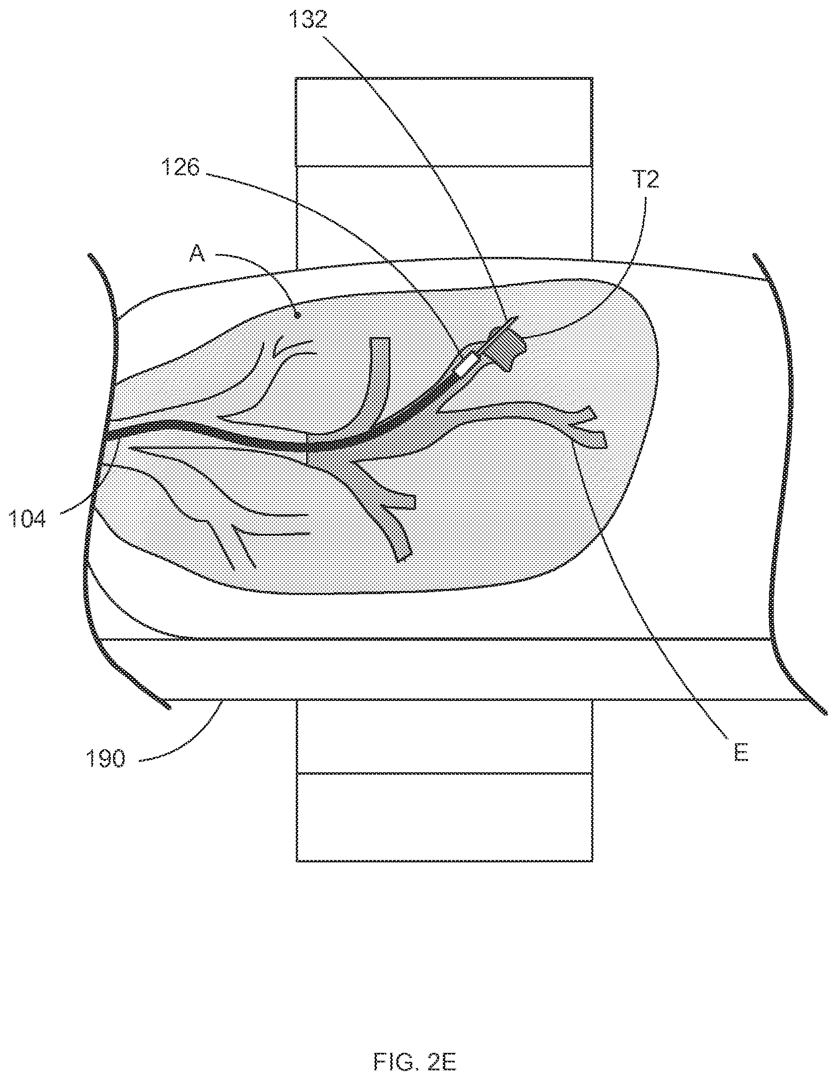 Patent US12318159 Figure 7 – Systems and methods for robotic medical system integration with external imaging