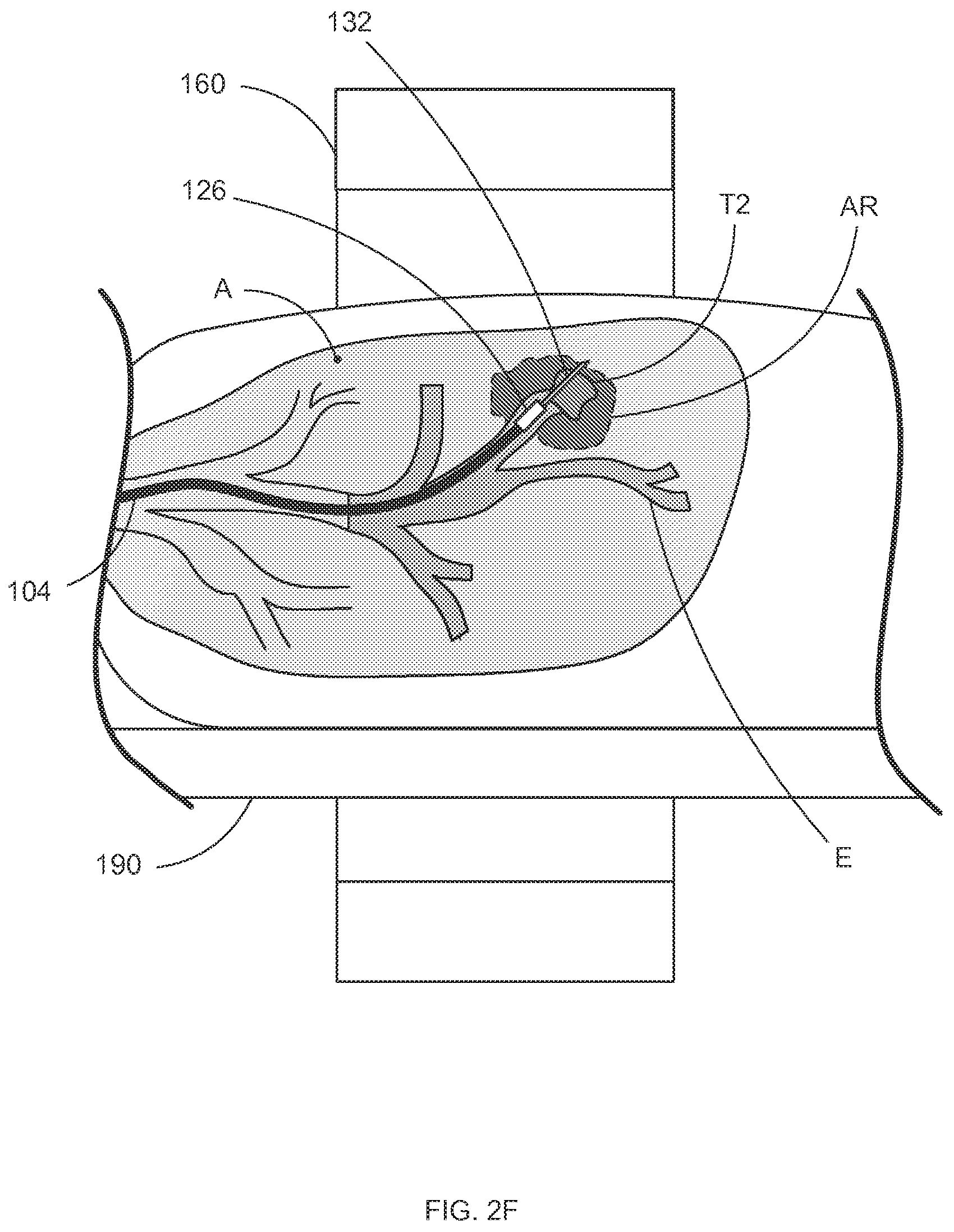 Patent US12318159 Figure 8 – Systems and methods for robotic medical system integration with external imaging