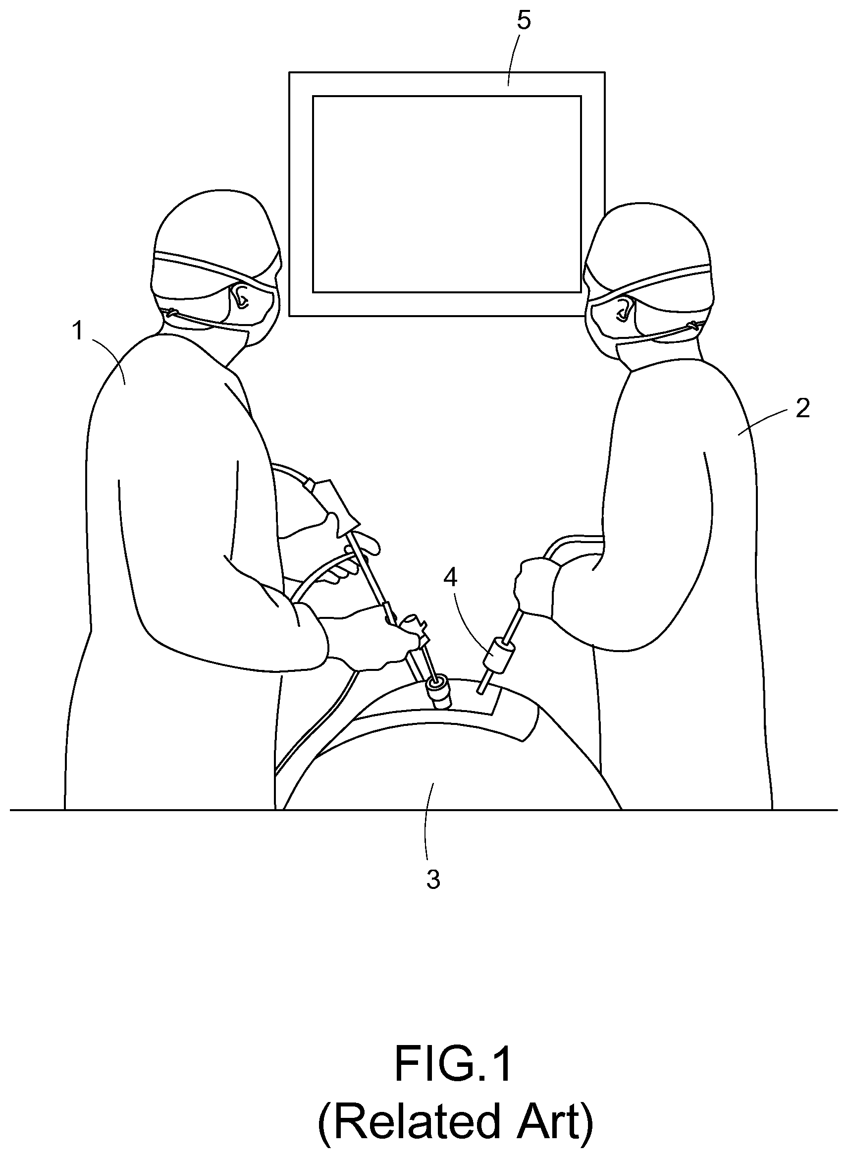 Patent US12318160 Figure 1 – Controlling system and controlling method of endoscopic surgical robot based on head tracking
