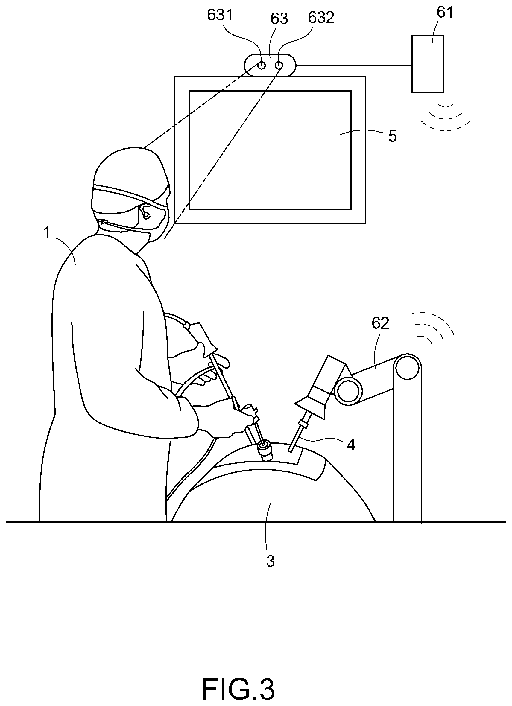 Patent US12318160 Figure 3 – Controlling system and controlling method of endoscopic surgical robot based on head tracking