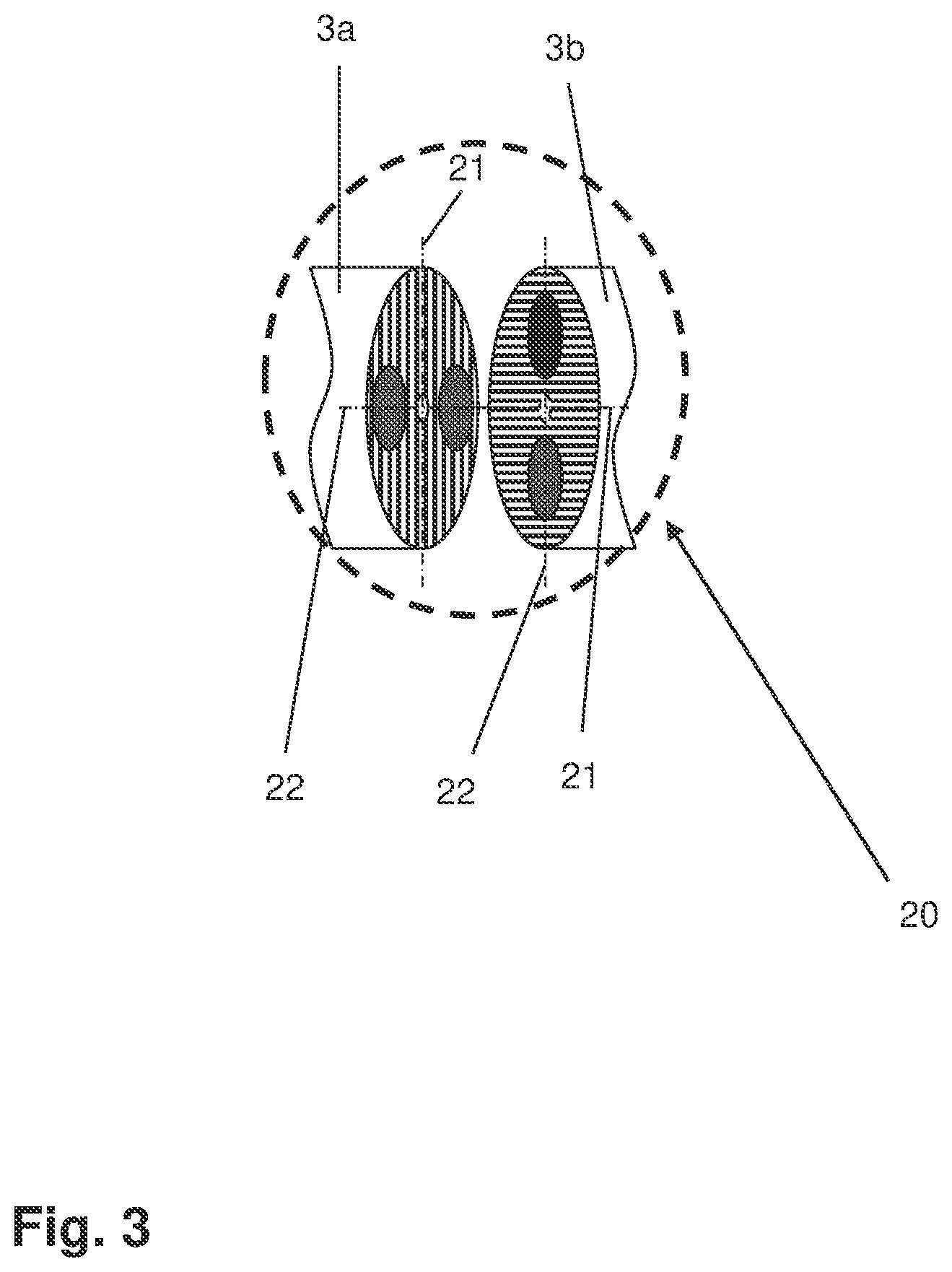 Patent US12318167 Figure 3 – Assembly for carrying out an optical coherence tomography