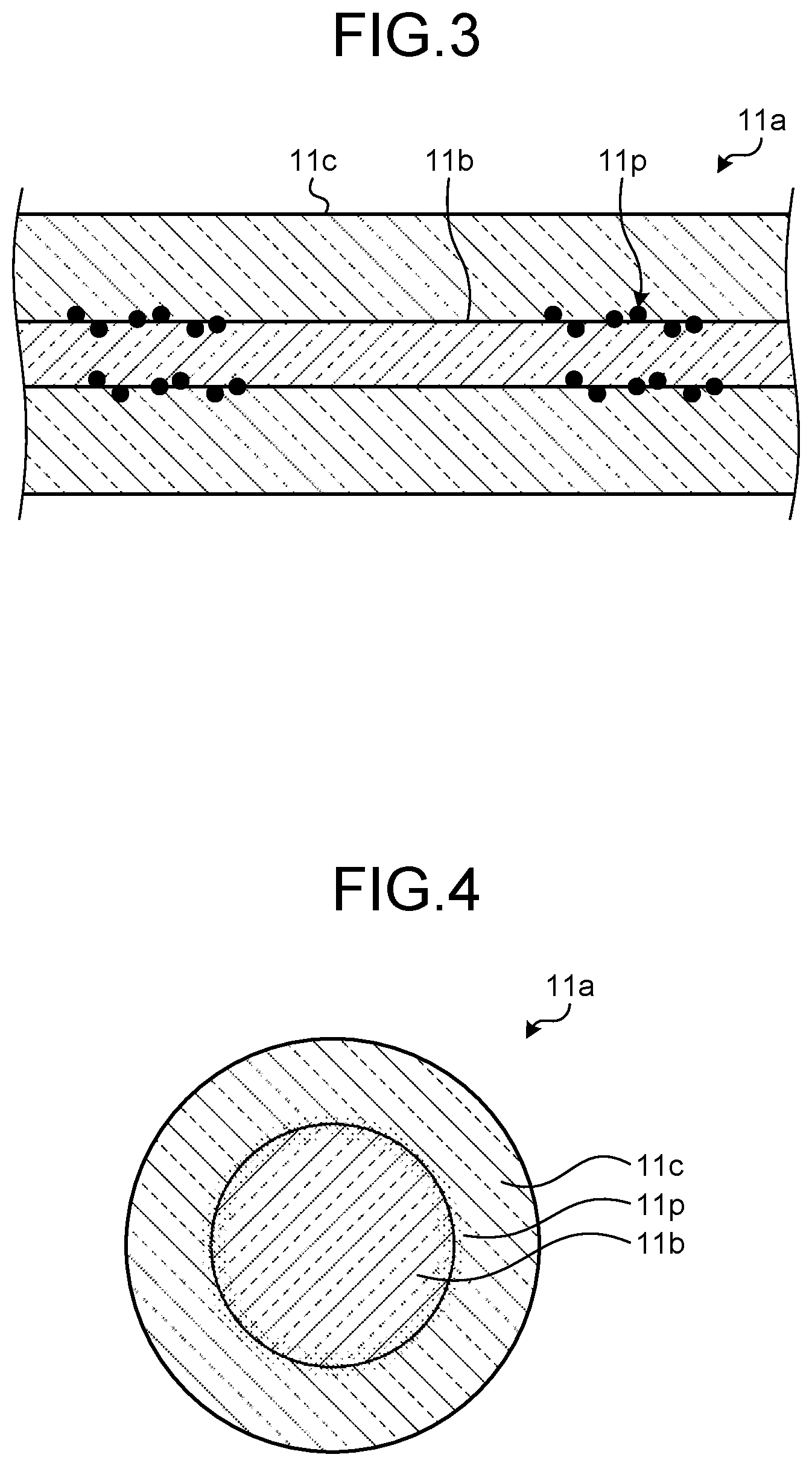 Patent US12318168 Figure 2 – In vivo pressure measurement device