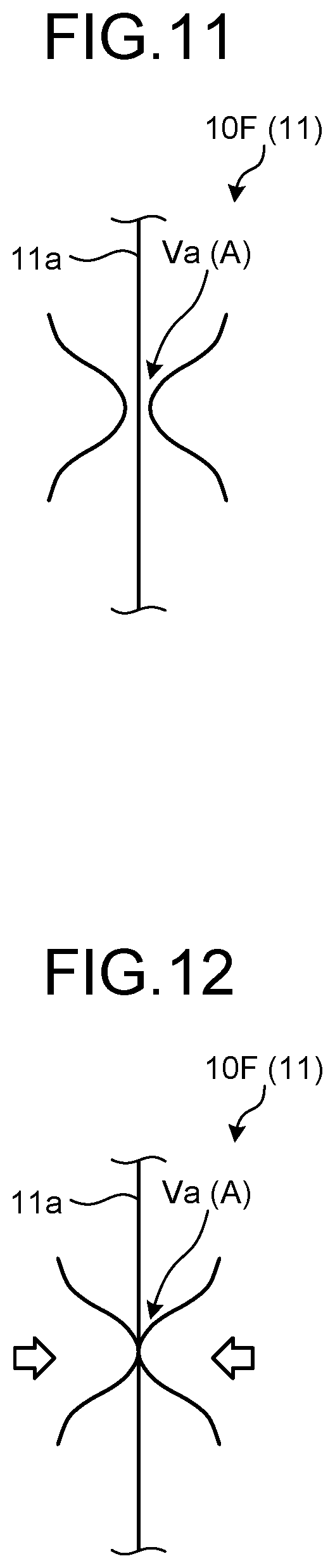 Patent US12318168 Figure 6 – In vivo pressure measurement device