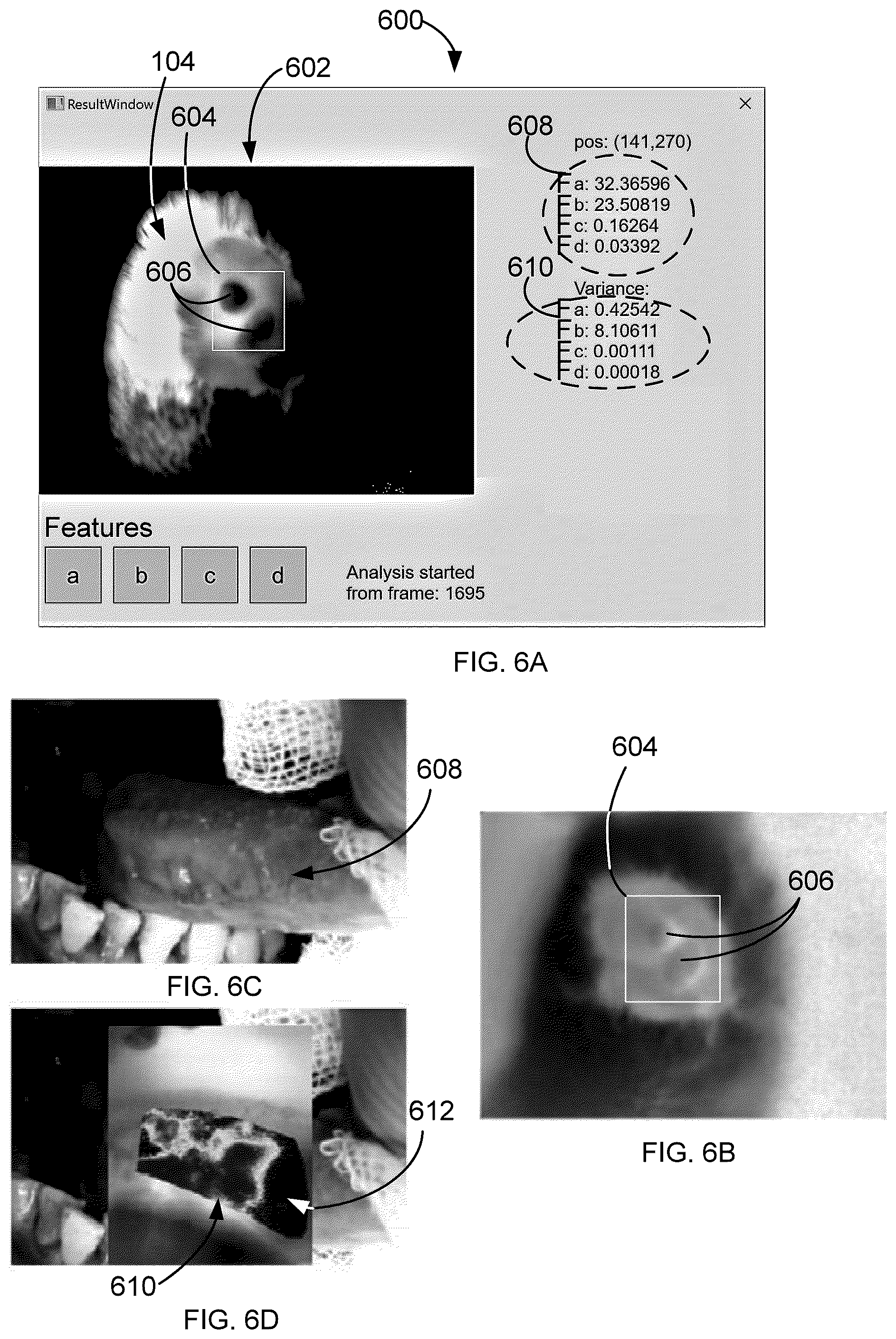 Patent US12318169 Figure 7 – System, method and computer product for differentiating between tissue states and types