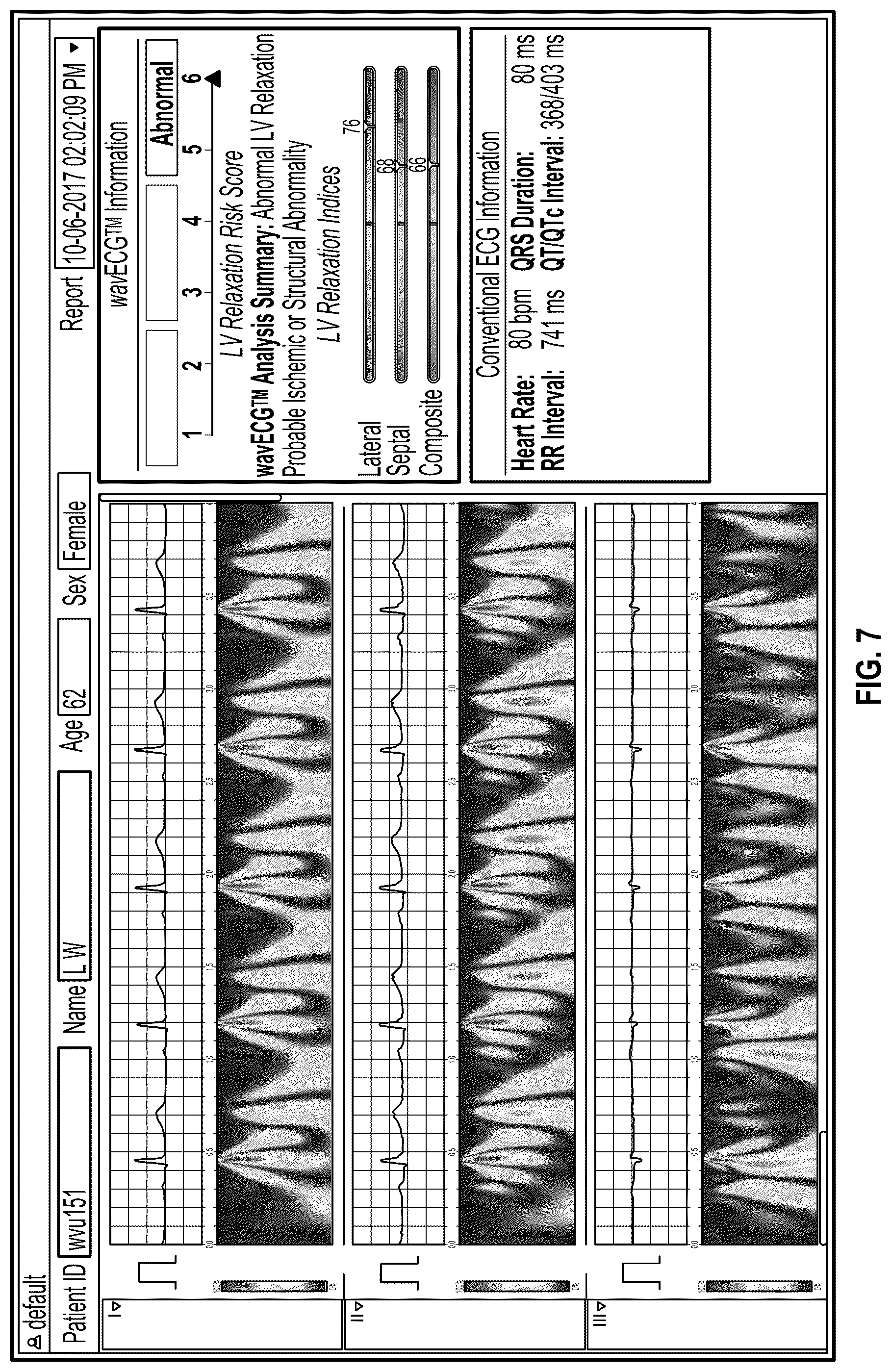 Patent US12318172 Figure 7 – Electrocardiogram-based estimation of echocardiography parameters