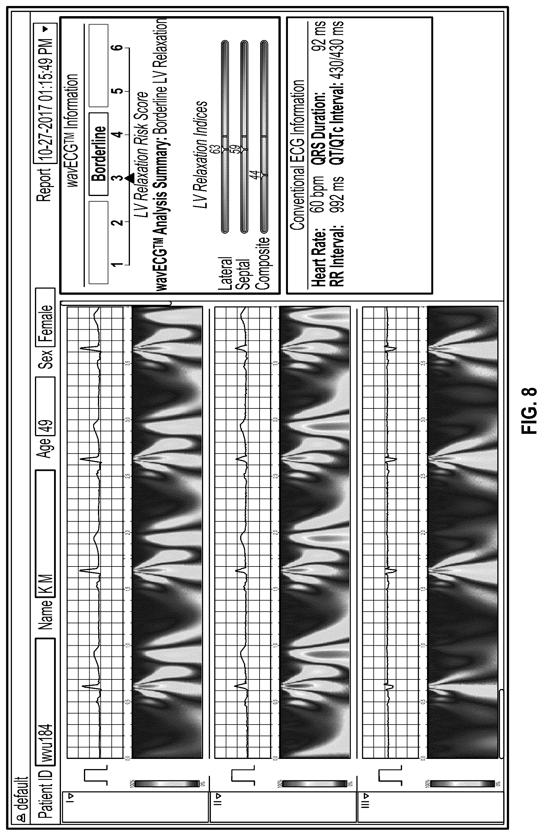 Patent US12318172 Figure 8 – Electrocardiogram-based estimation of echocardiography parameters