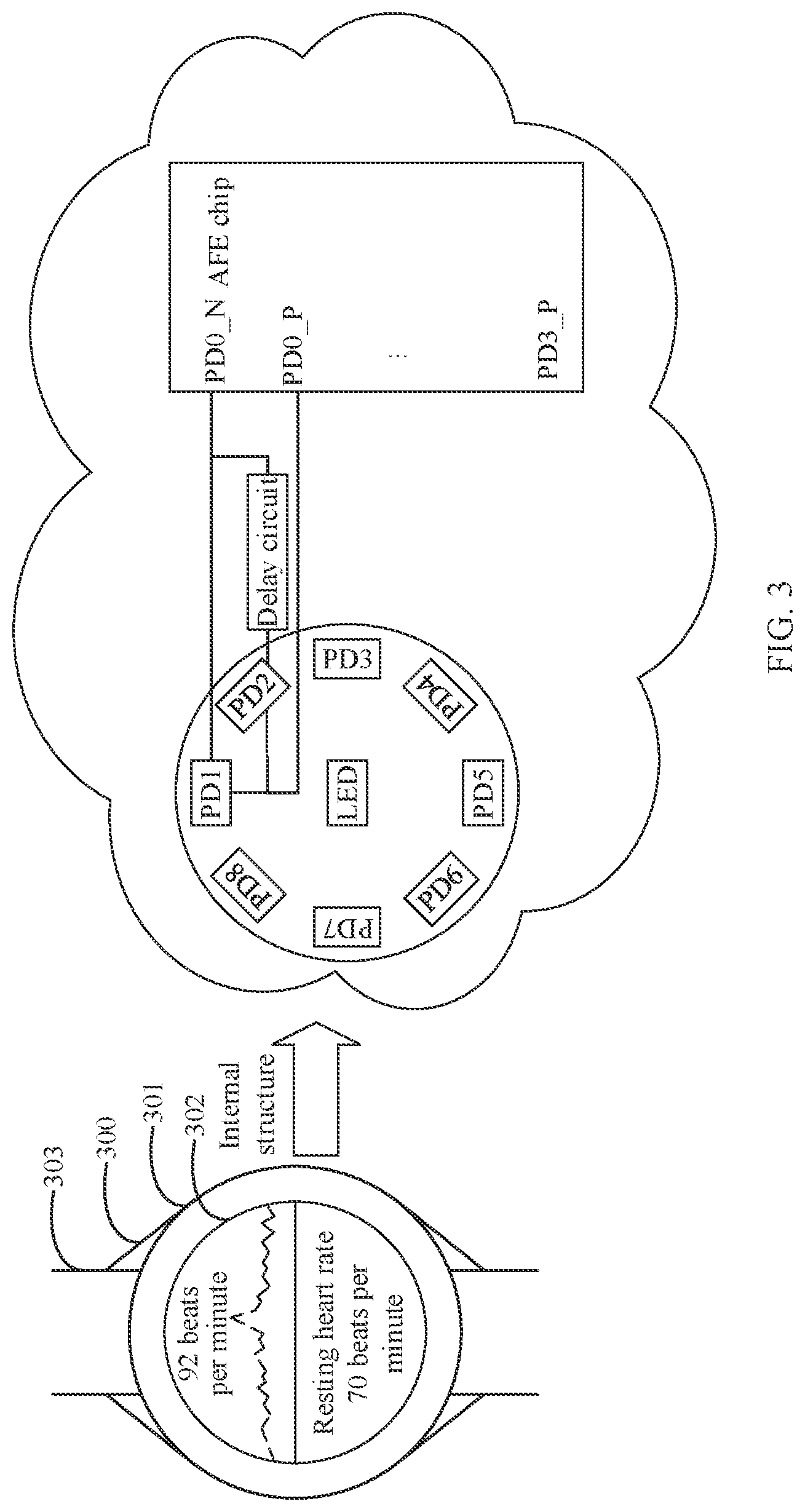 Patent US12318177 Figure 3 – Terminal based on photo plethysmo graph PPG