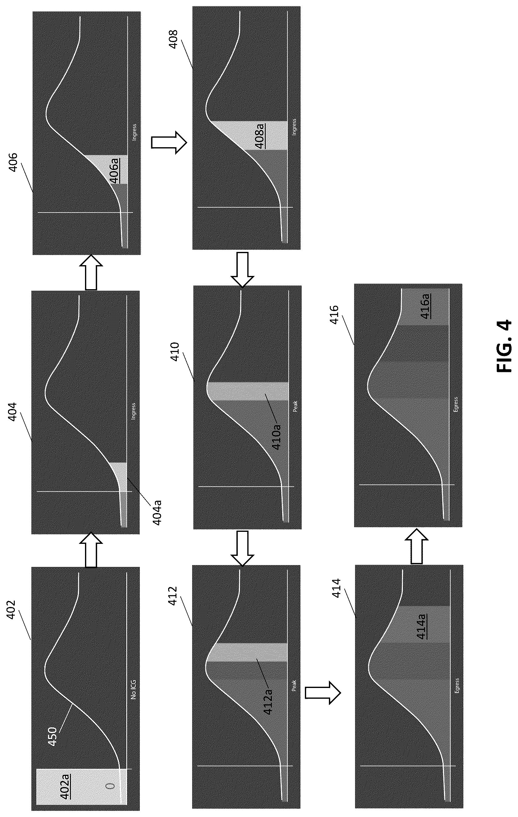 Patent US12318179 Figure 5 – Systems and methods for determining timing for fluorescence based blood flow assessment