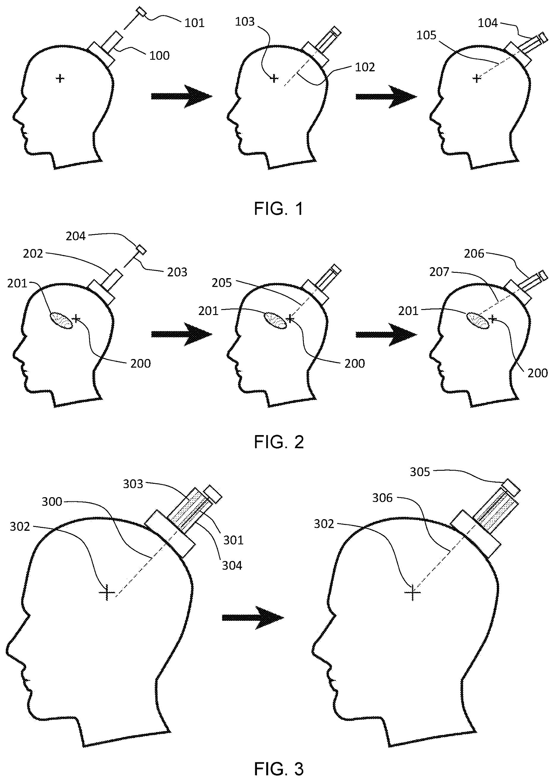 Patent US12318183 Figure 1 – Methods for biomedical targeting and delivery and devices and systems for practicing the same