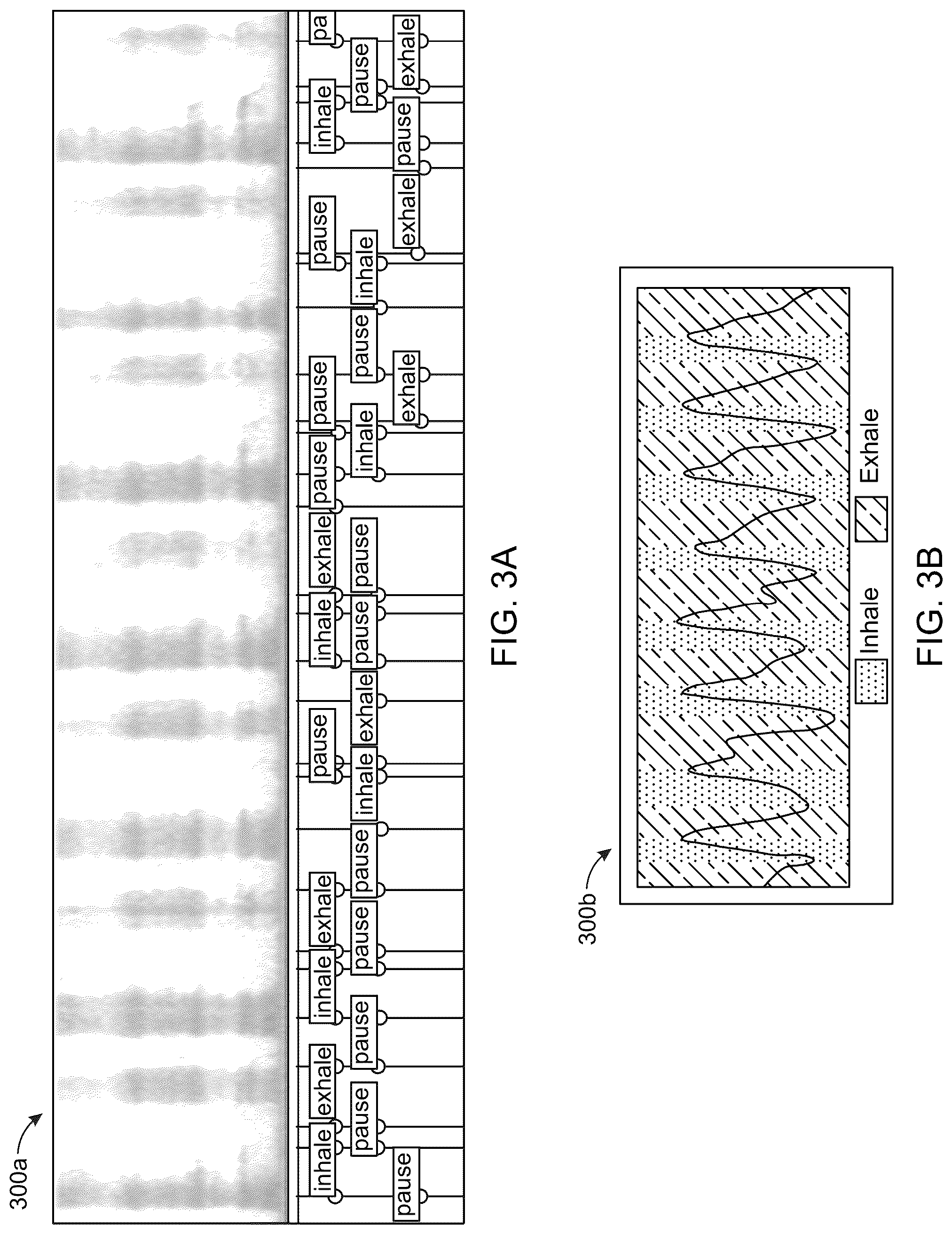 Patent US12318185 Figure 4 – Breathing measurement and management using an electronic device