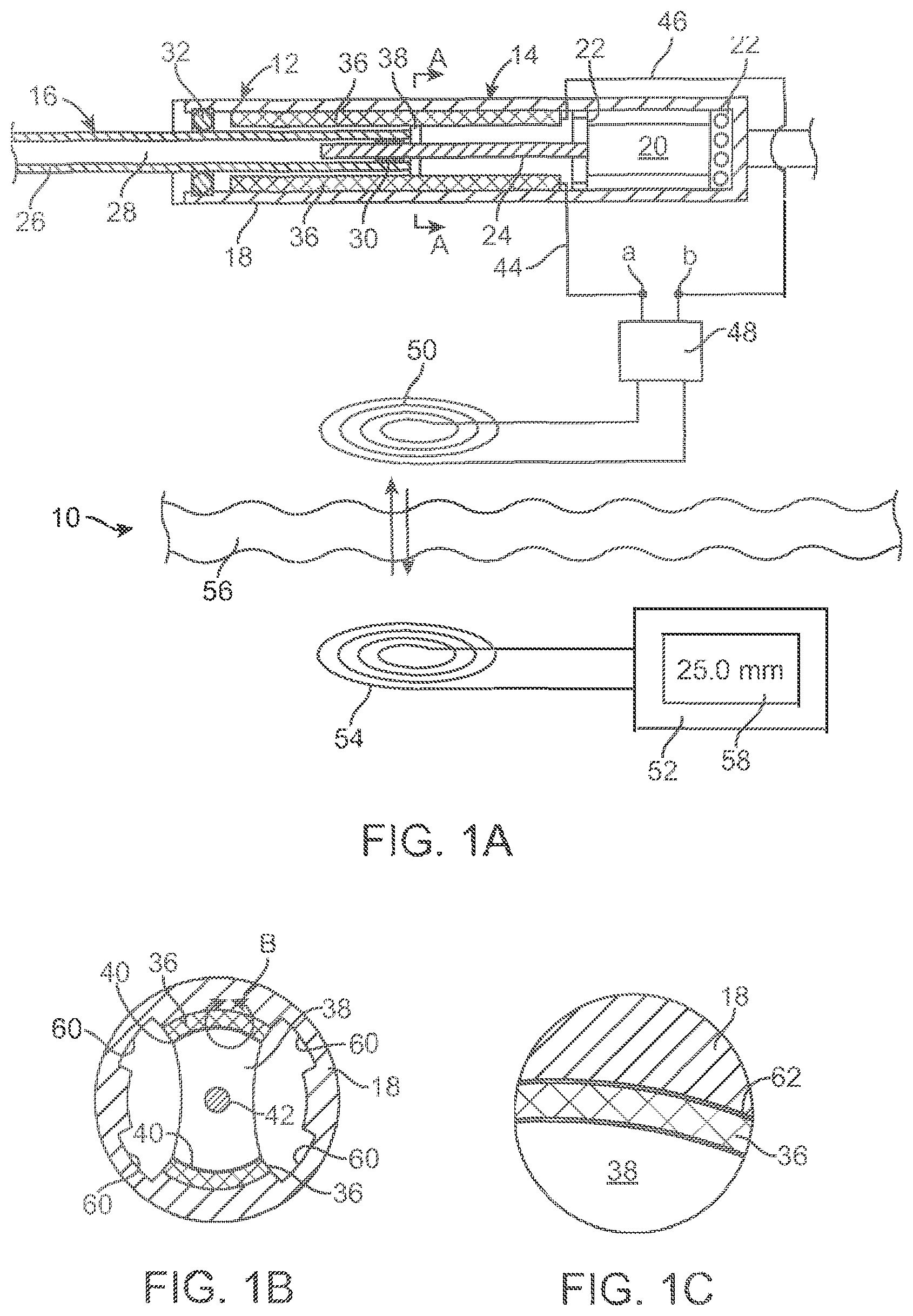 Patent US12318187 Figure 1 – Devices and methods for non-invasive implant length sensing