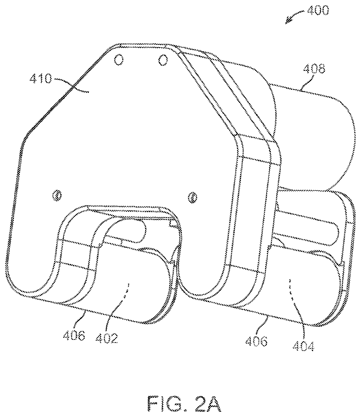 Patent US12318187 Figure 3 – Devices and methods for non-invasive implant length sensing