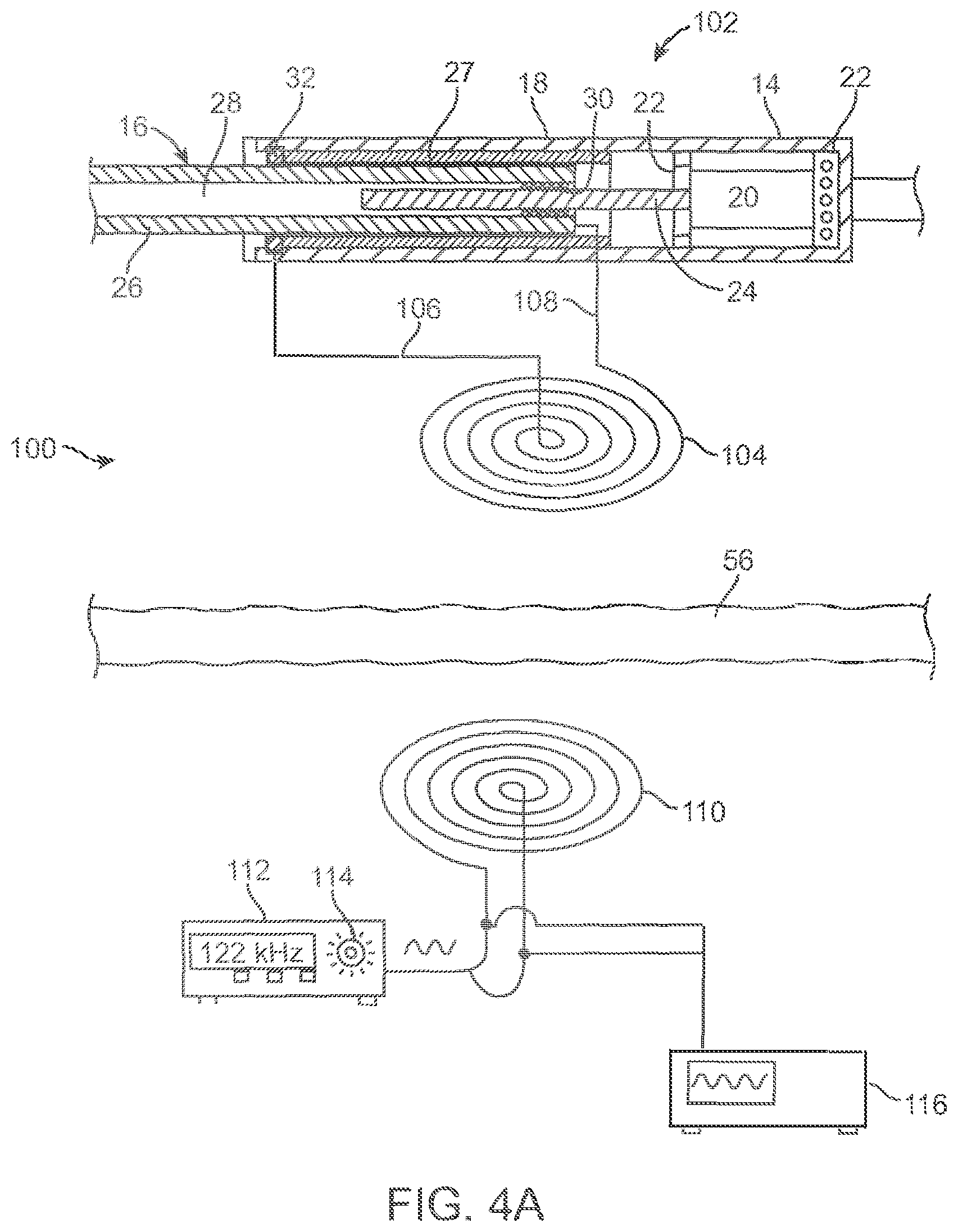Patent US12318187 Figure 7 – Devices and methods for non-invasive implant length sensing