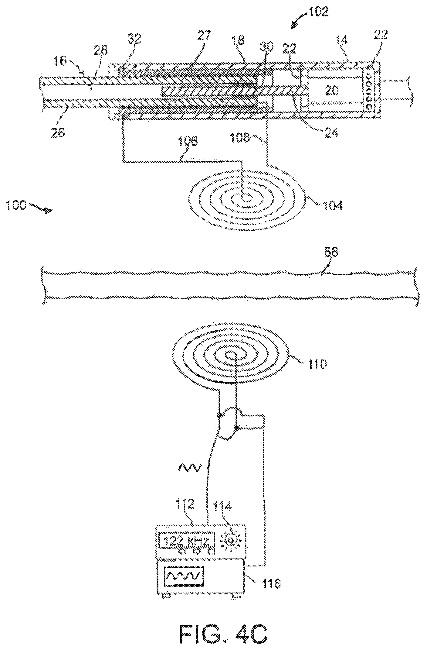 Patent US12318187 Figure 9 – Devices and methods for non-invasive implant length sensing