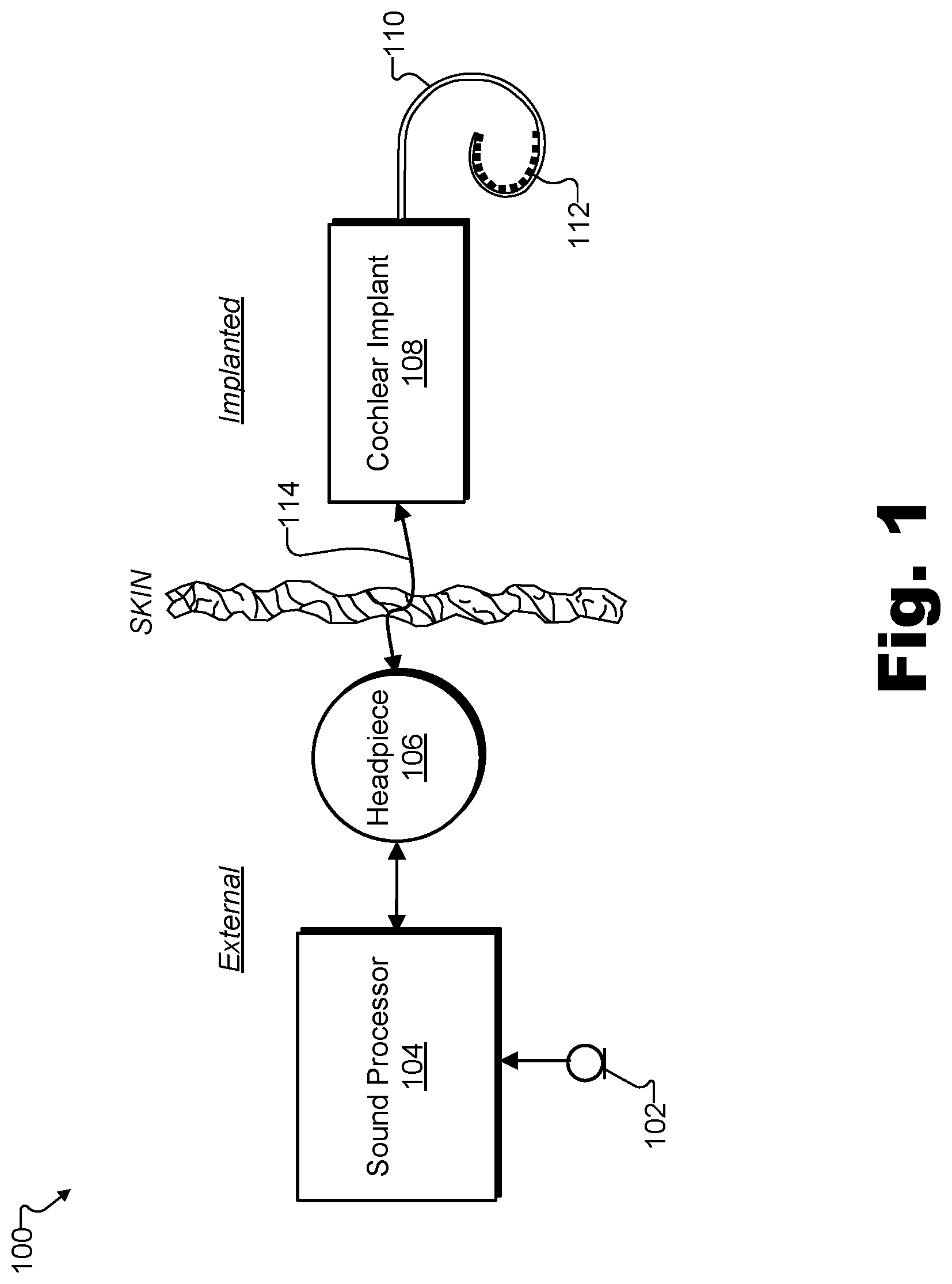 Patent US12318194 — Sound delivery apparatuses for audiometric measurements — Figure 1
