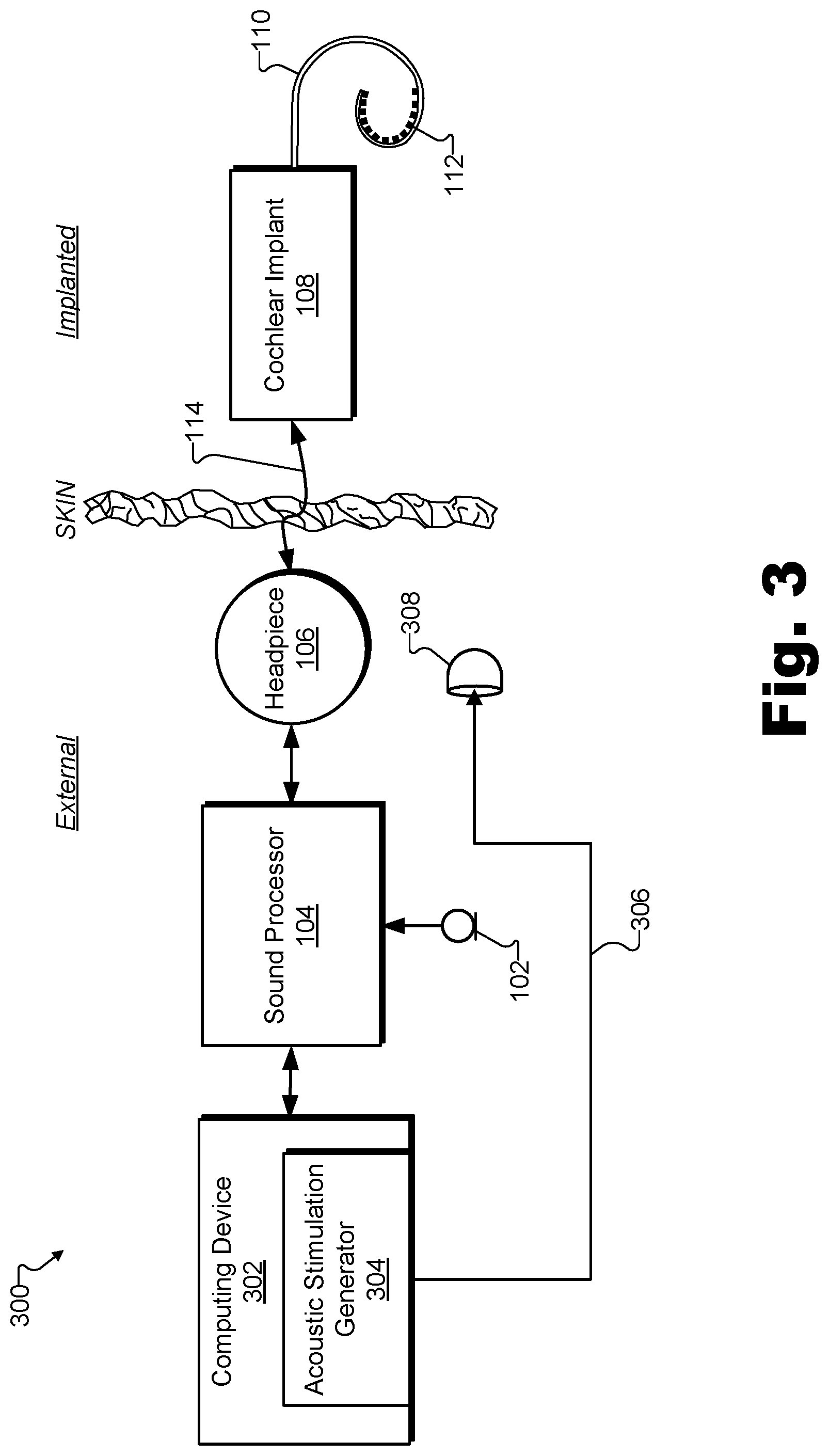 Patent US12318194 Figure 3 – Sound delivery apparatuses for audiometric measurements