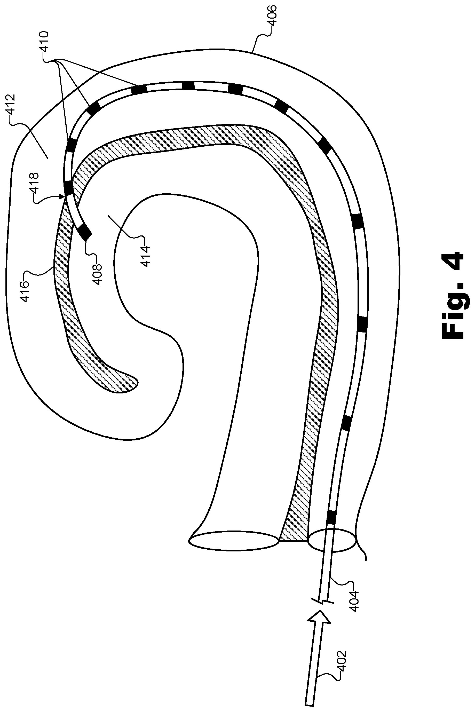 Patent US12318194 Figure 4 – Sound delivery apparatuses for audiometric measurements