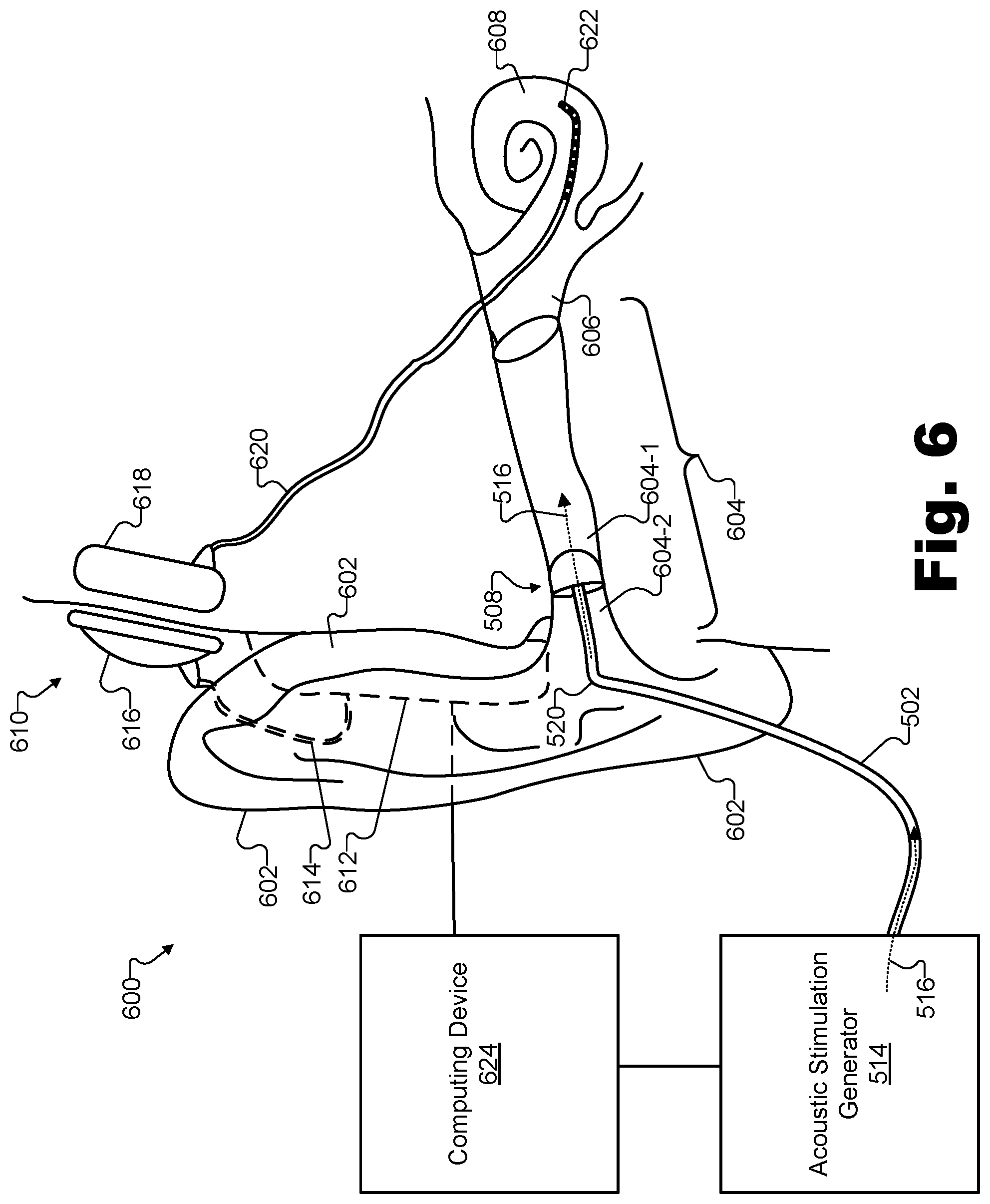 Patent US12318194 Figure 6 – Sound delivery apparatuses for audiometric measurements