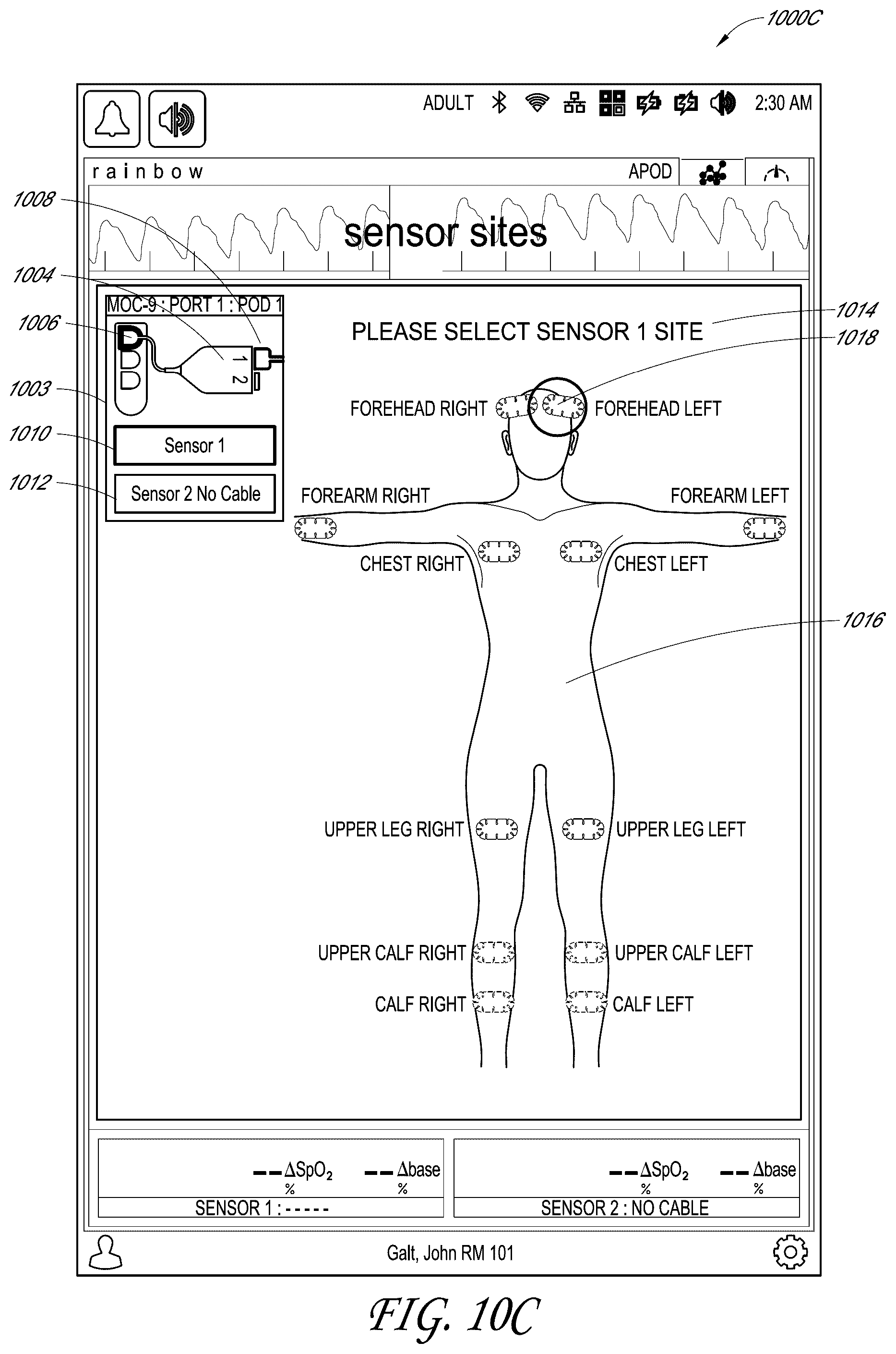Patent US12318196 Figure 14 – Regional oximetry user interface