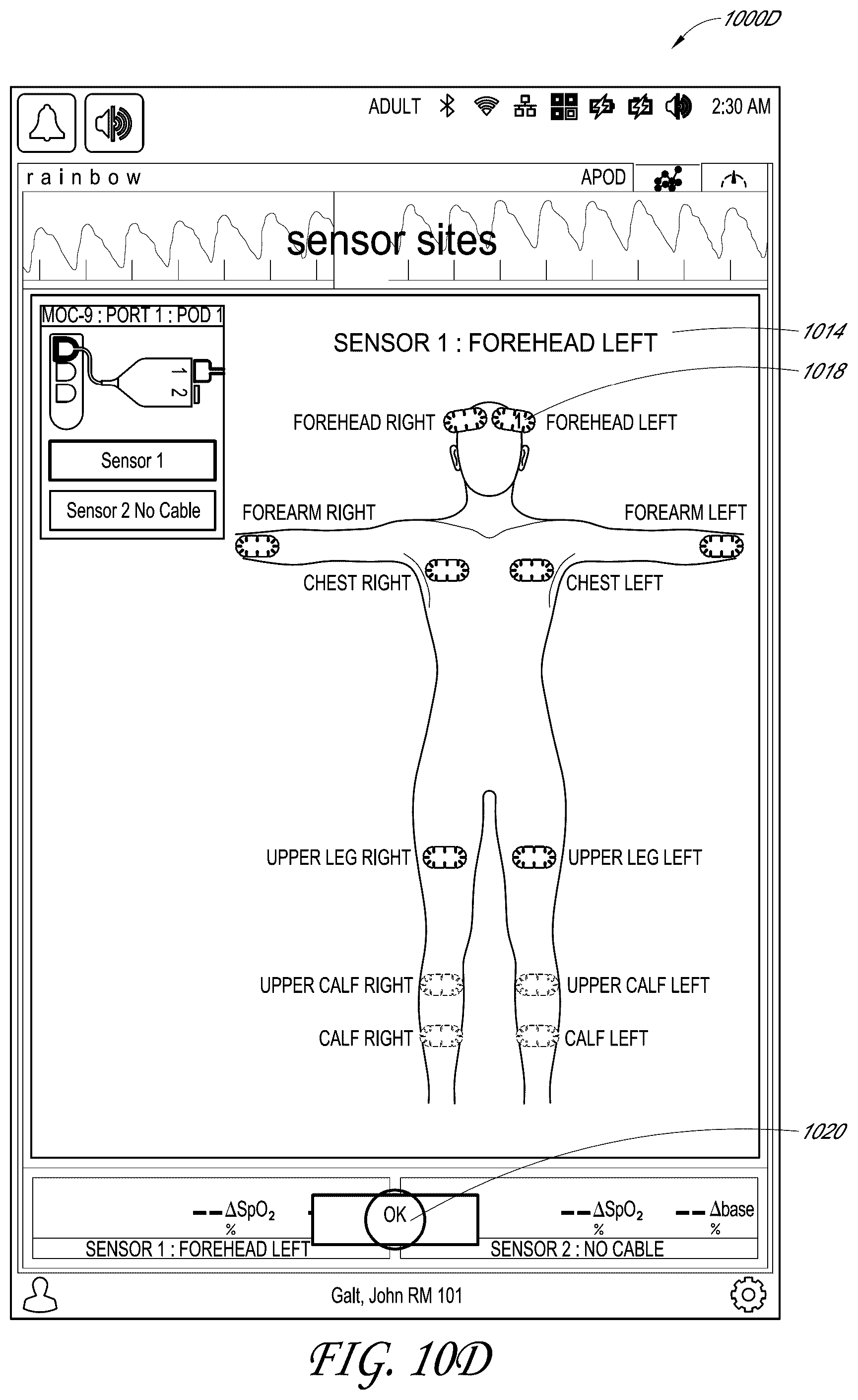 Patent US12318196 Figure 15 – Regional oximetry user interface