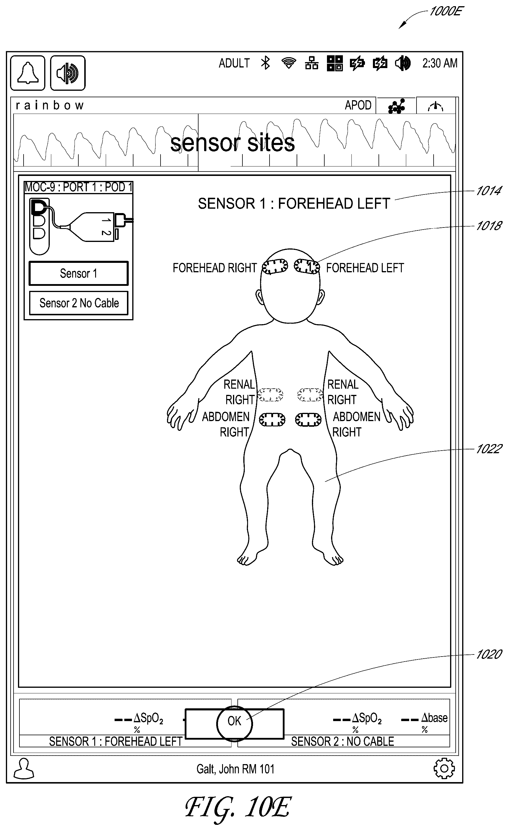 Patent US12318196 Figure 16 – Regional oximetry user interface